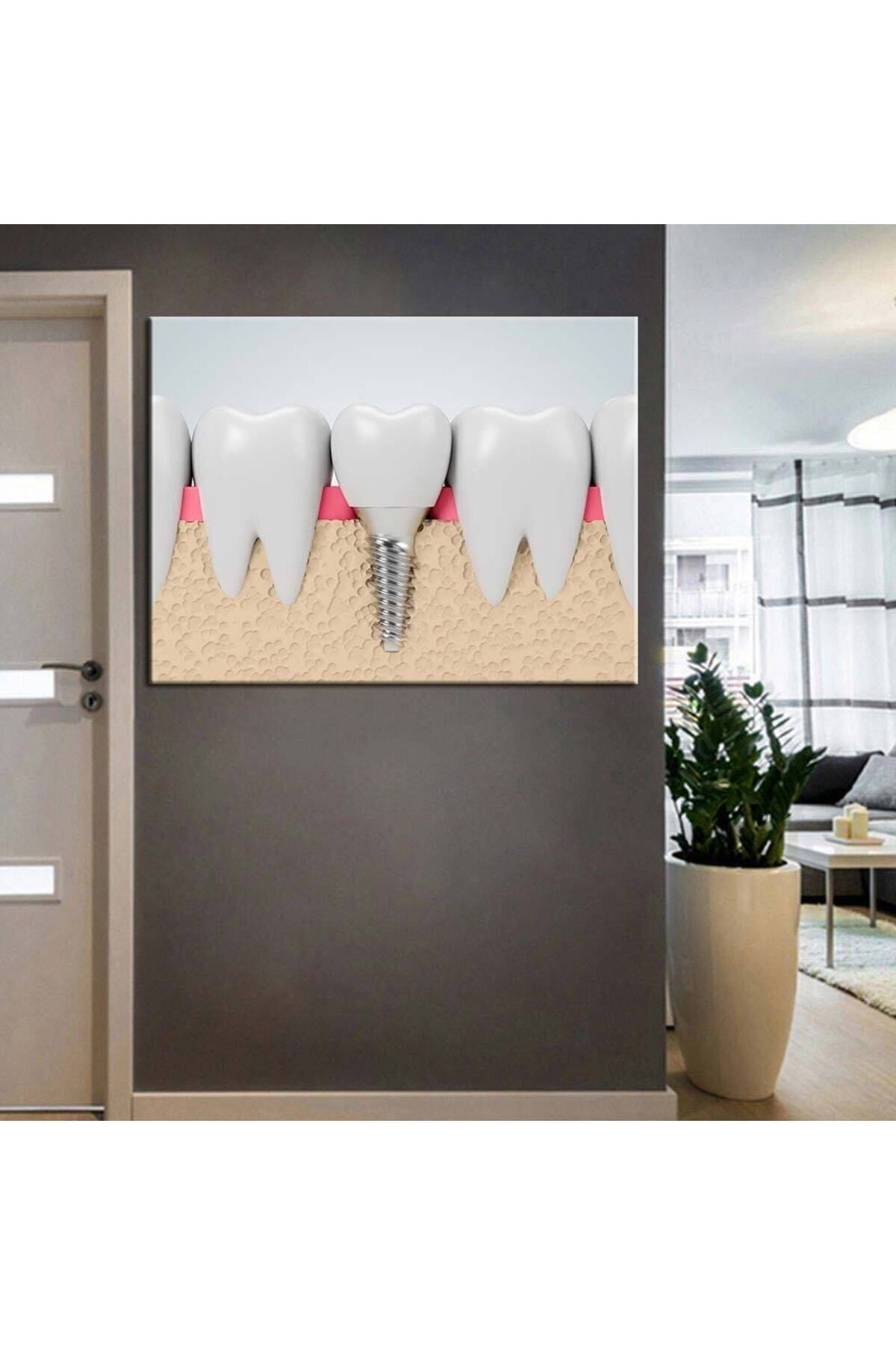 Vividale Ağız Ve Diş Sağlığı Polikliniği tabloları Dekoratif Diş, Dekoratif Dişçi, Dişçi Dekorasyonu