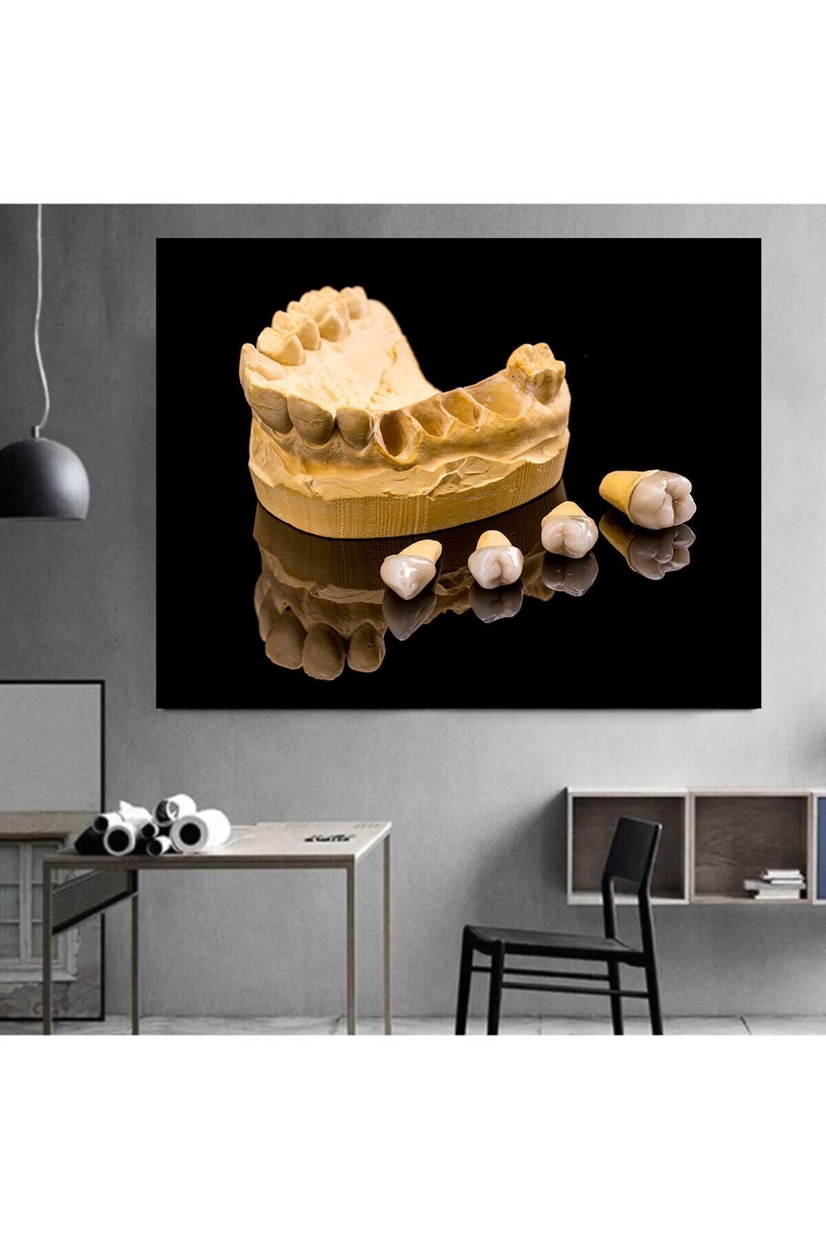 Vividale DENTAL DİŞ HD KALİTE KANVAS TABLO