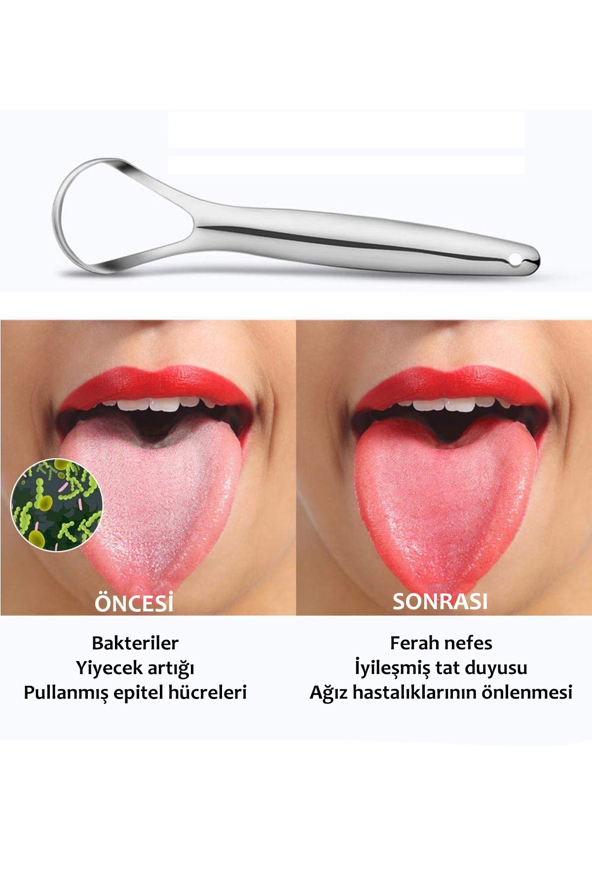 Soillium-Stainless Steel Tongue Scraper Metal Tongue Scraper Cleaner for a Fresh Breath and Clean Tongue 1 Piece 8