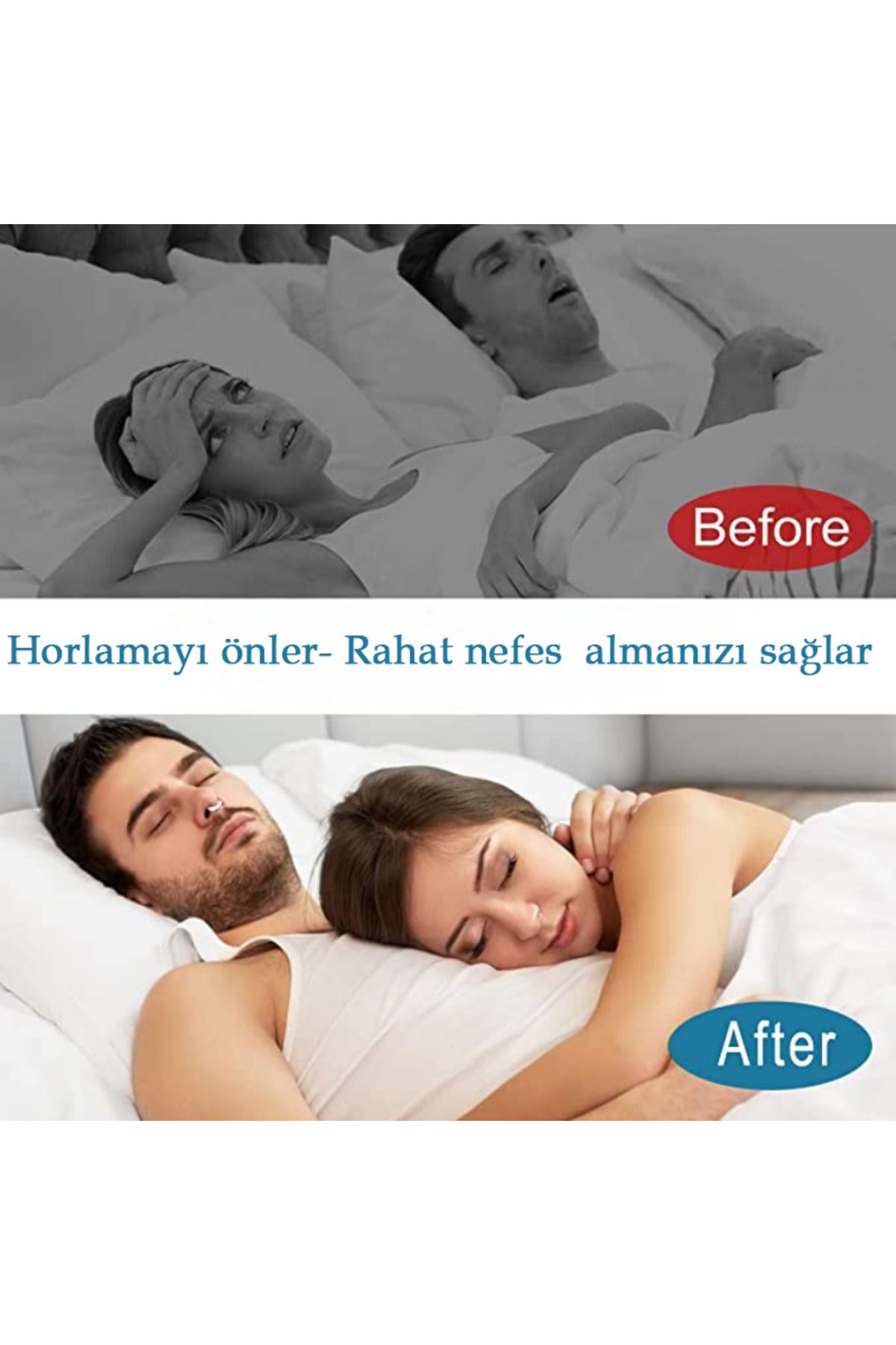 INVOKER-Silicone Nasal Dilator and Intra-Nose Anti-Snoring - L 5