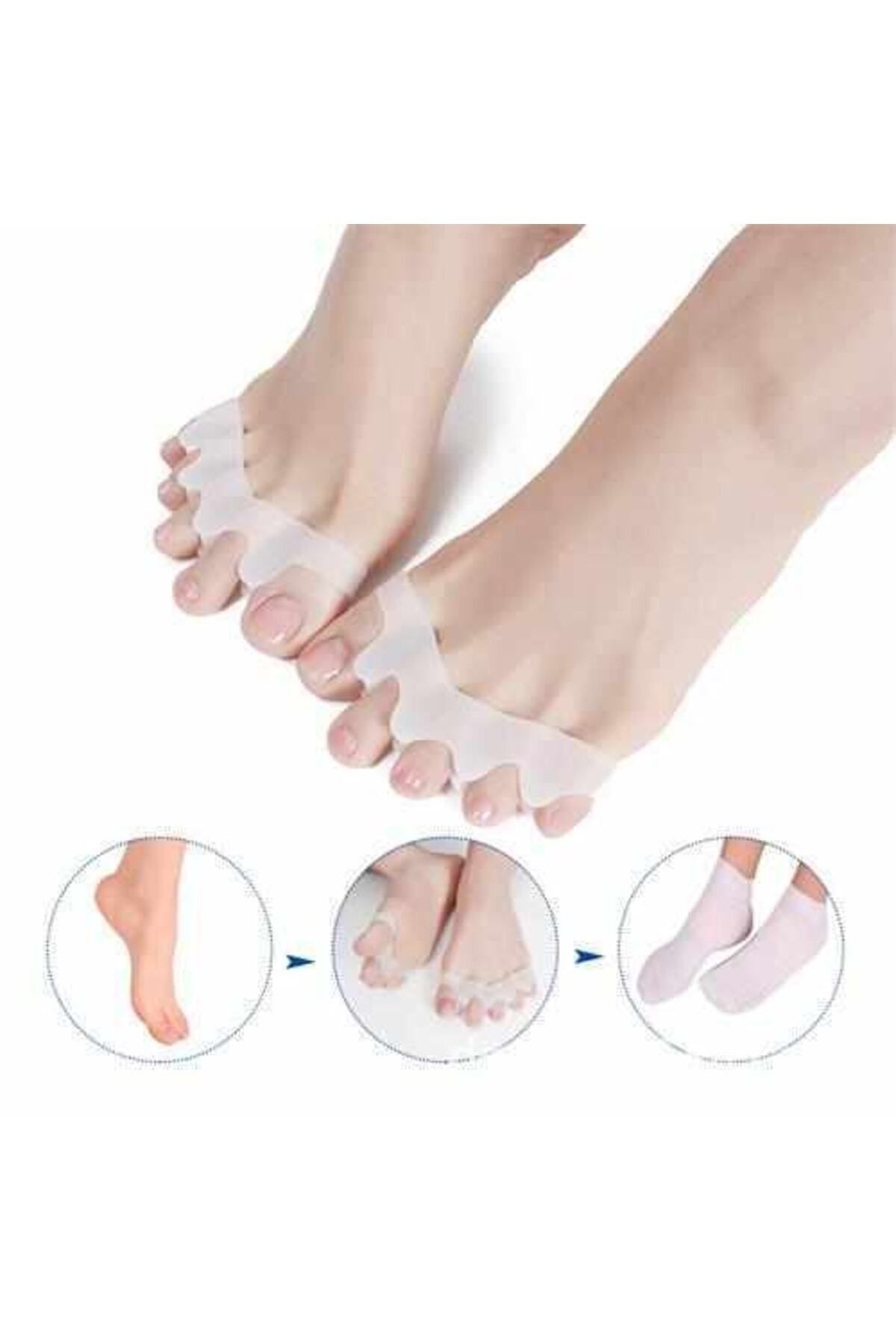 CNGZSHOP Valgus 5 Parmak Ayırıcı Silikon 711555Ç