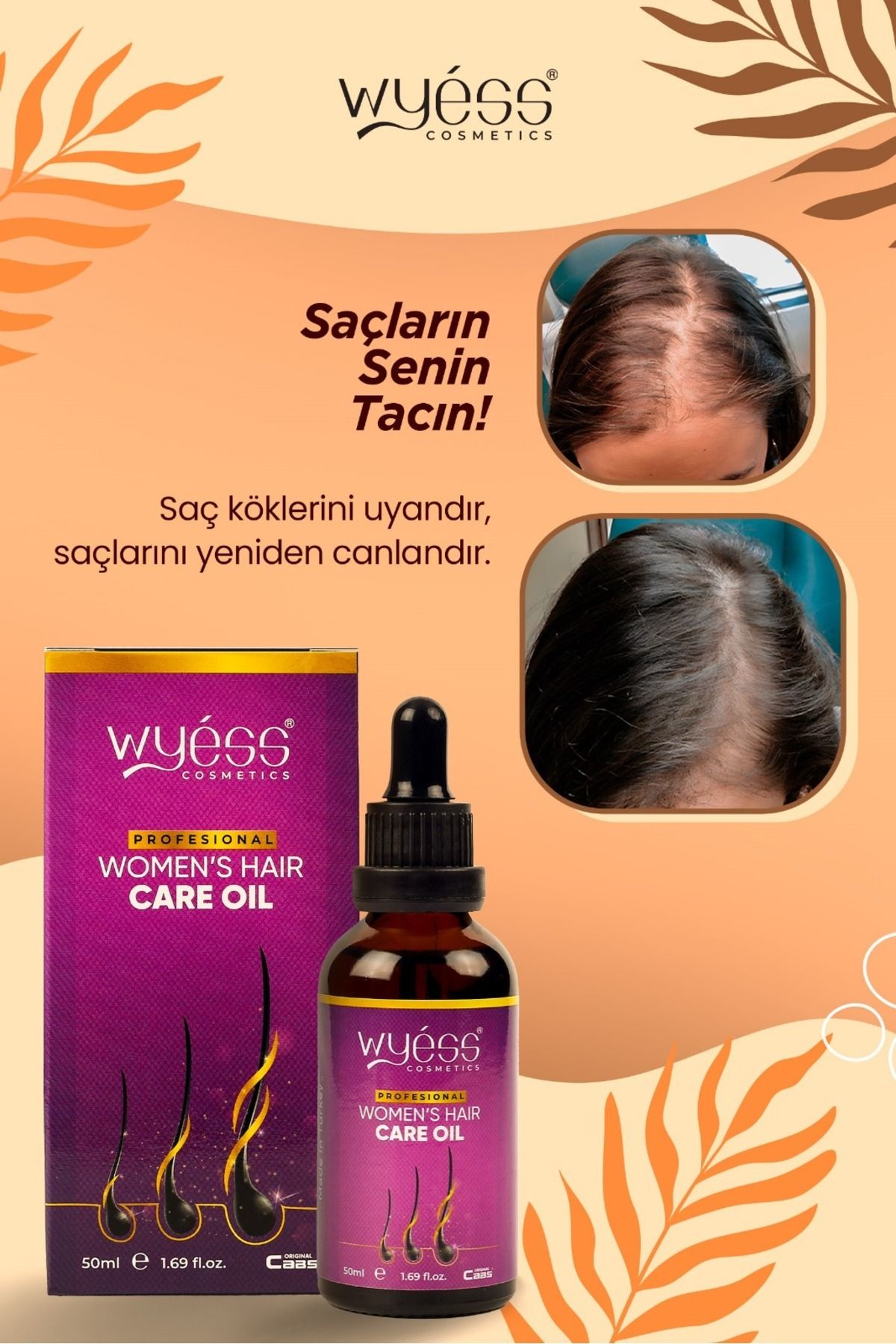 Wyess Kadın Saç Bakım Yağı-serumu Dökülme Karşıtı, Yeni Saç Teli Çıkaran, Kenevir Yağı 35 Yağ 50 ml-5