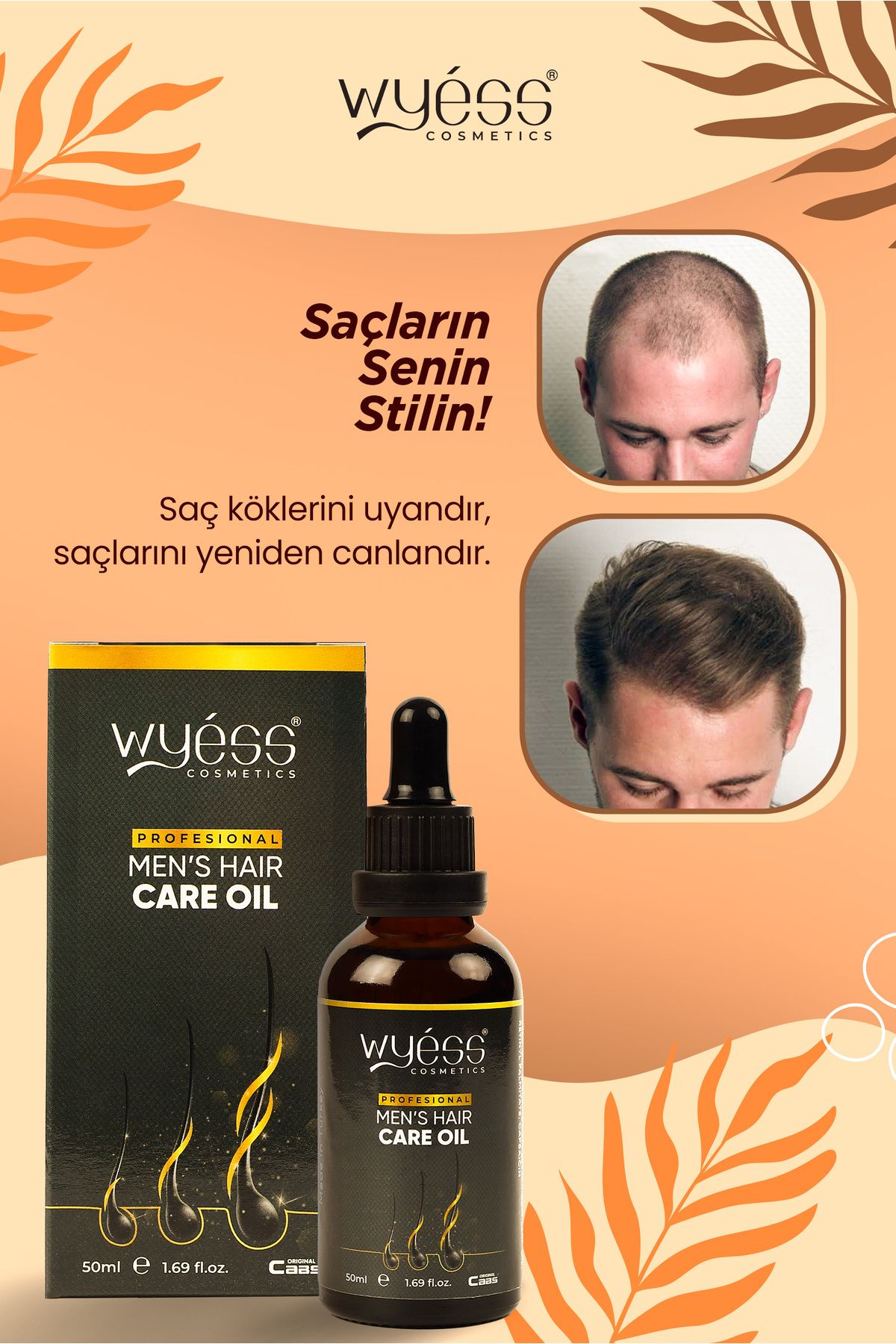 Wyess Erkek Saç Bakım Yağı-serumu Dökülme Karşıtı, Yeni Saç Teli Çıkaran, E / A Vitaminli 35 Yağ 50 ml-5