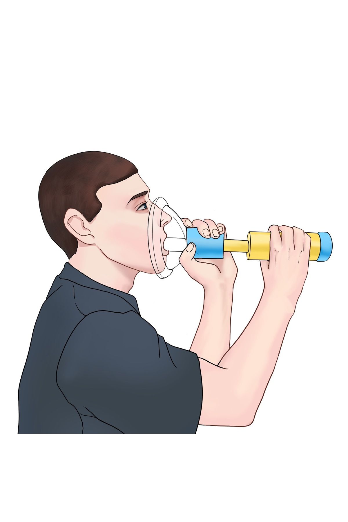 Choice-Upgrade Portable Anti Choking Device Choking Emergency Life Saving Suction Vac Anti Choke Device ... 3