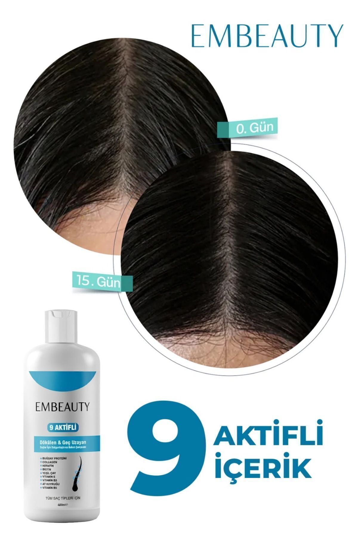 Embeauty Kolajen Ve Keratin Saç Dökülmesine Karşı Hızlı Sac Uzatan Dolgunlaştırıcı Onarıcı Besleyici Şampuan