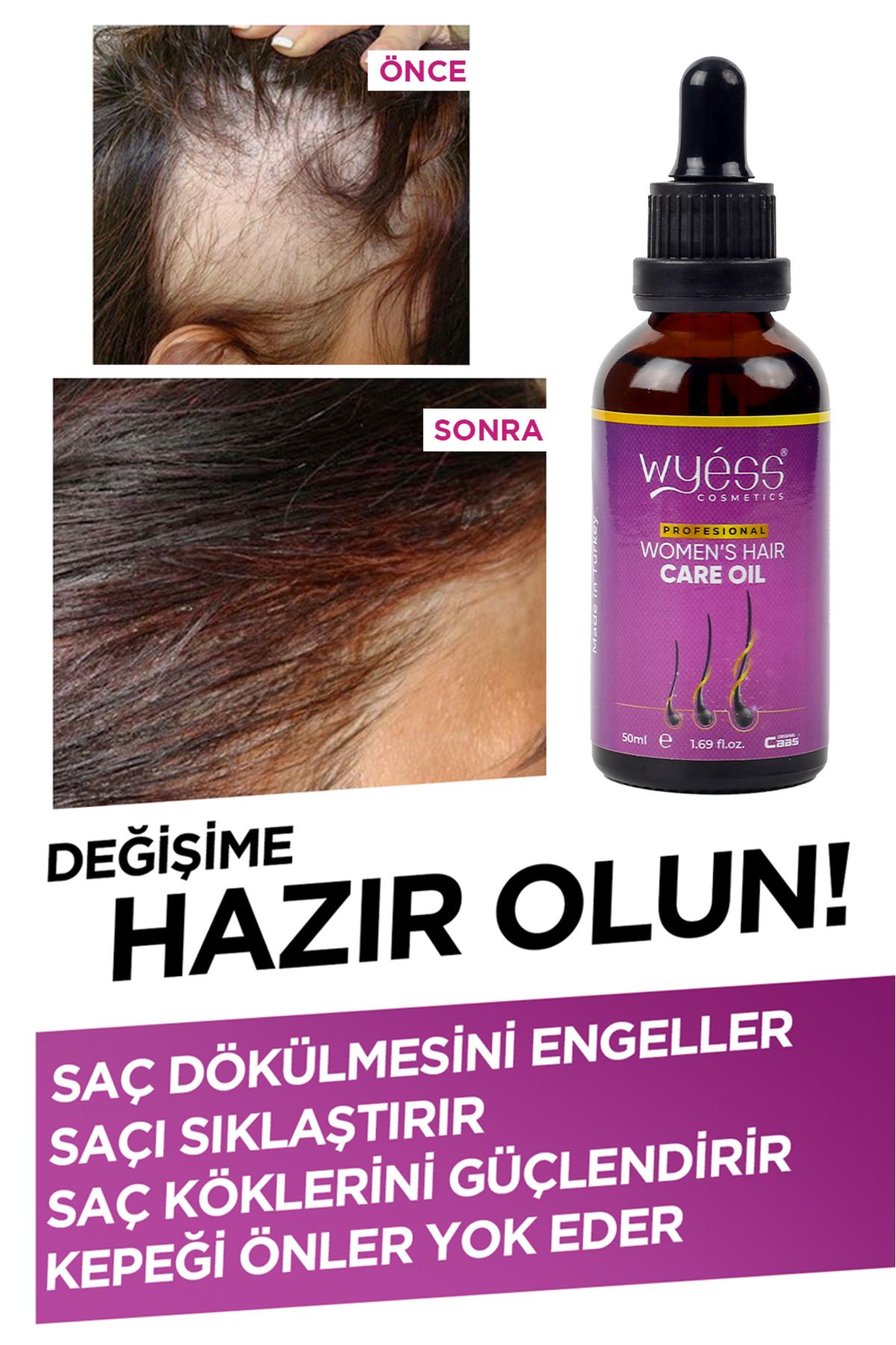 Wyess Kadın Saç Bakım Yağı-serumu Dökülme Karşıtı, Yeni Saç Teli Çıkaran, Kenevir Yağı 35 Yağ 50 ml-6