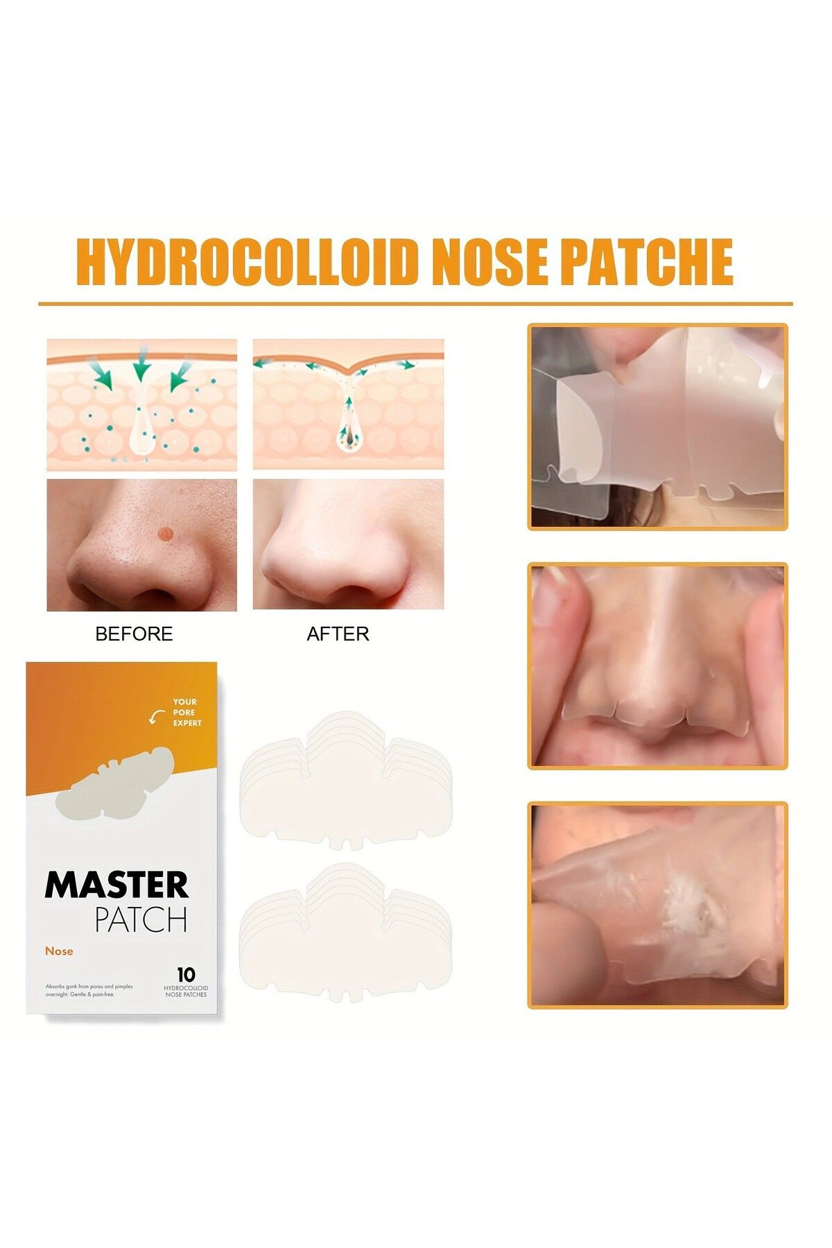 Choice-10Pcs Patch Nose Hydrocolloid Patches For Nose Pores,Pimples,Zits And Oil, Overnight Pore Strips ... 7