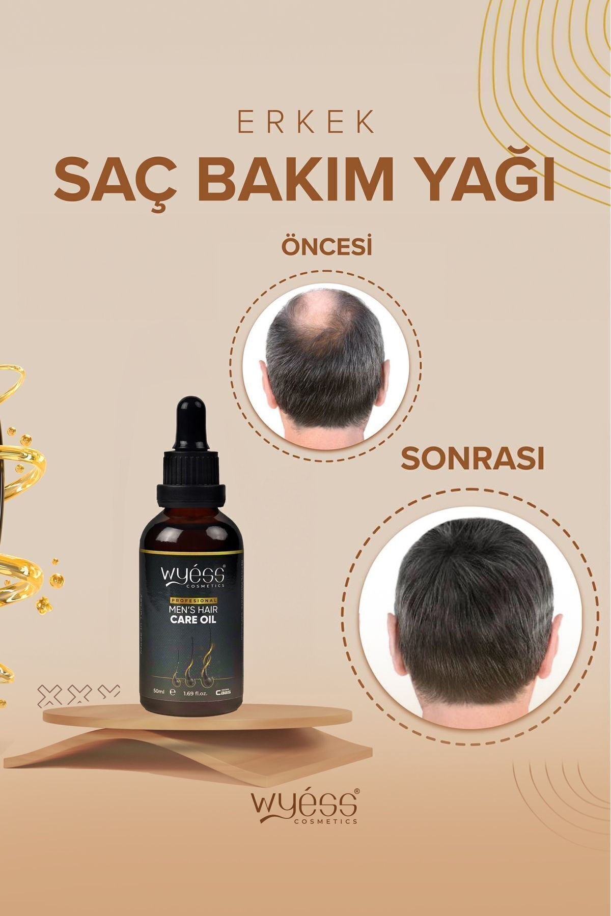 Wyess Erkek Saç Bakım Yağı-serumu Dökülme Karşıtı, Yeni Saç Teli Çıkaran, E / A Vitaminli 35 Yağ 50 ml-3