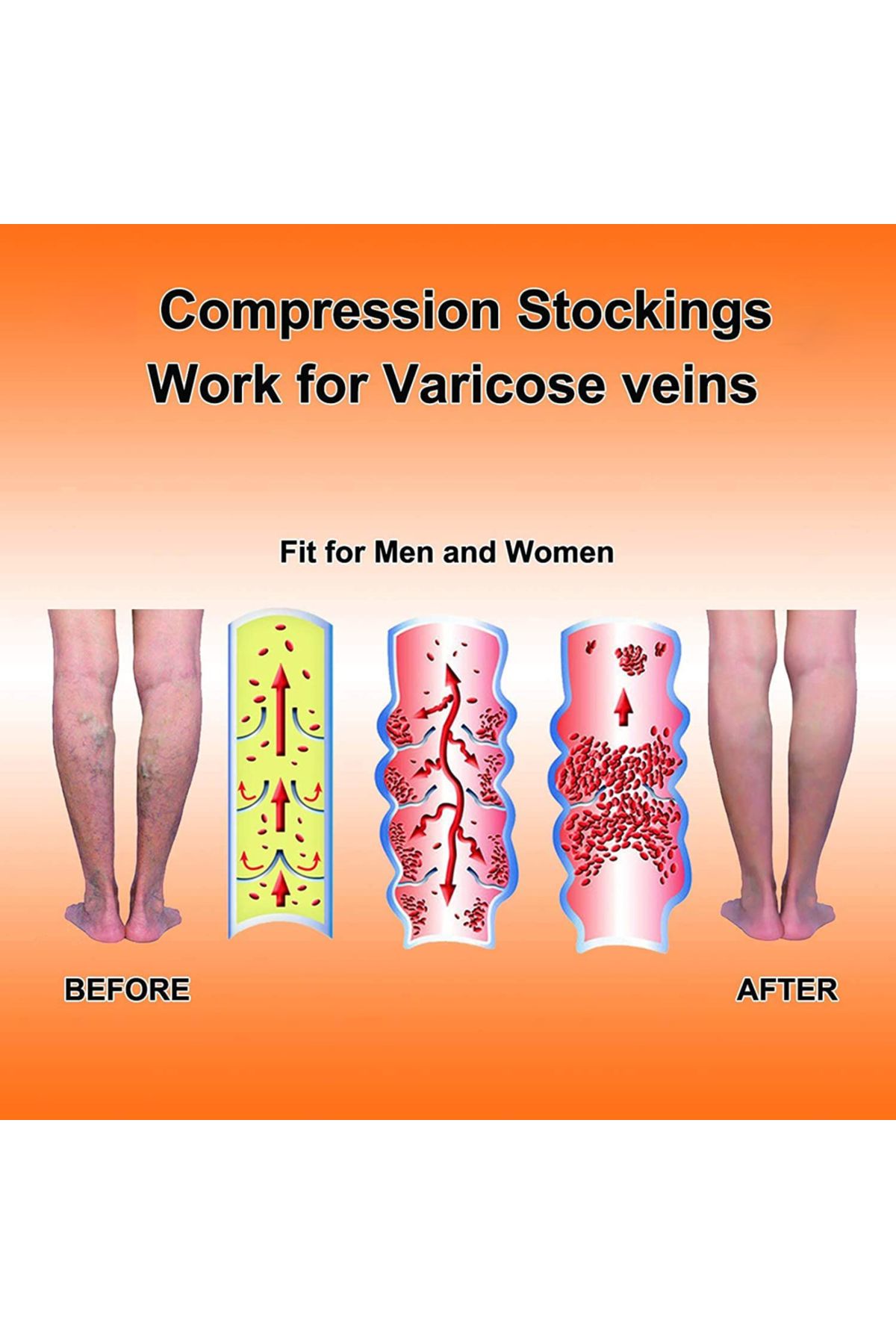 Choice-Medical Calf Compression Sleeve 30-40mmhg Men Women Footless Calves Compression Sleeves Varicose ... 6