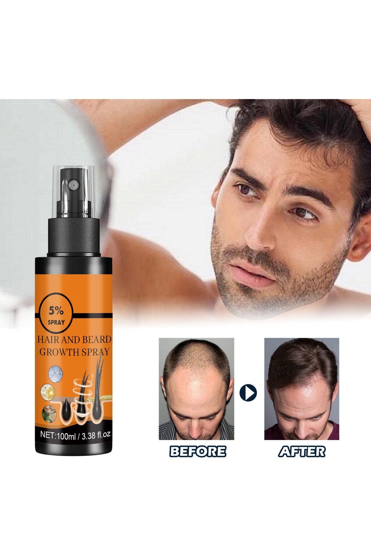 Choice Hair Growth Spray, Promote Hair Growth, Nourish Scalp, Hair