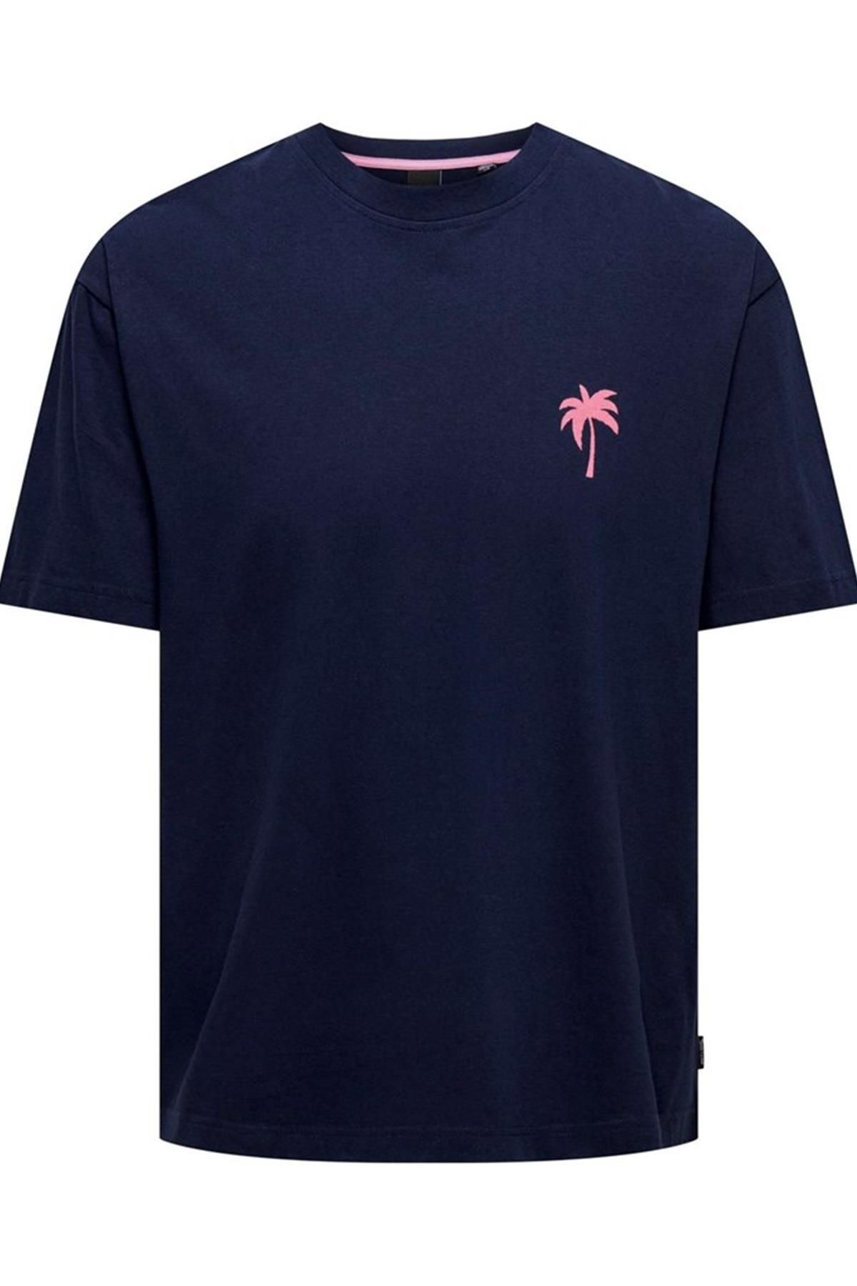 Only & Sons-Onsmervyn Life Rlx Summer Ss Tee 22029519   Navy Blue 6