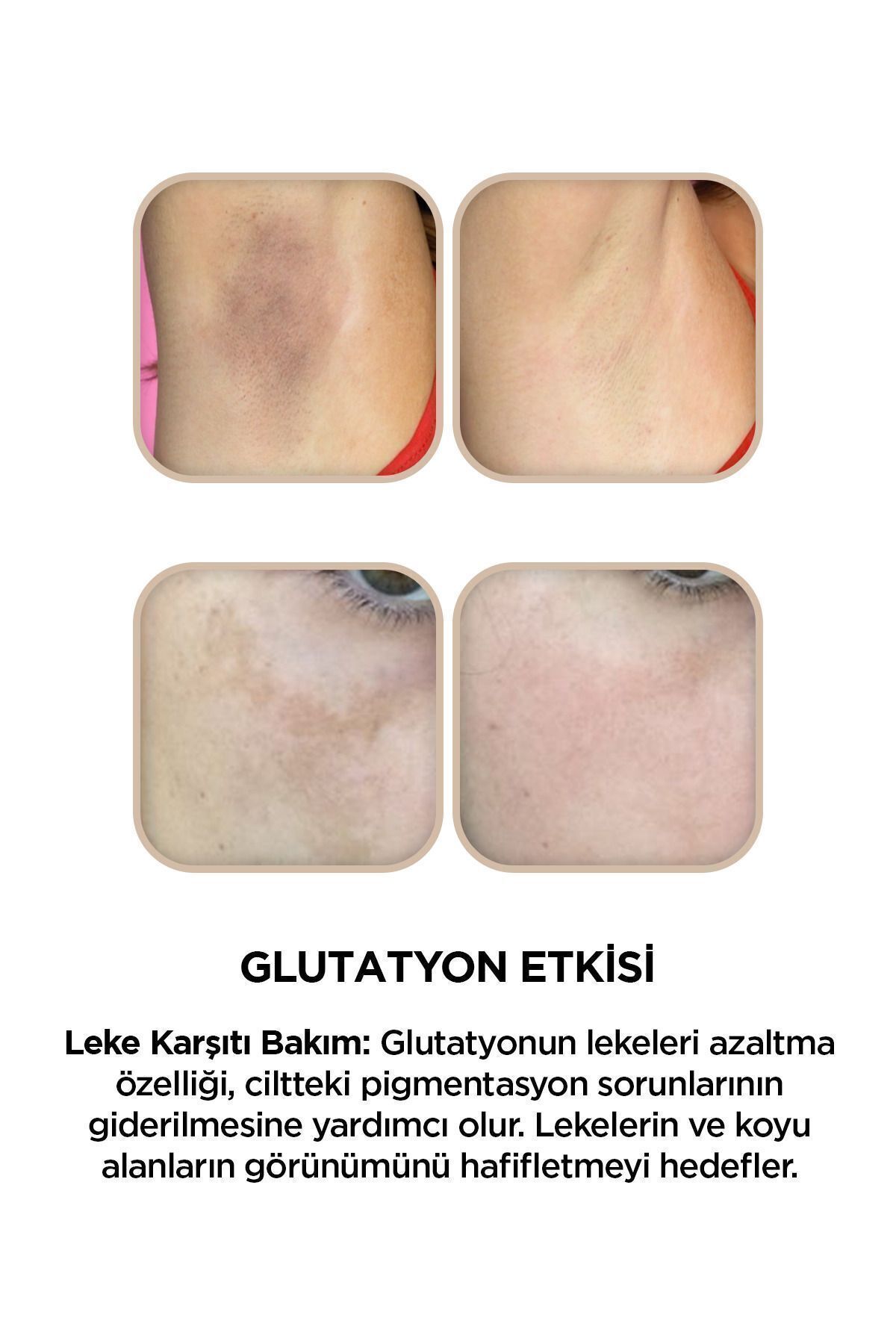 https://cdn.dsmcdn.com/ty1592/prod/QC/20241022/10/3168a121-a586-386d-a328-a2fae8df00fe/1_org_zoom.jpg