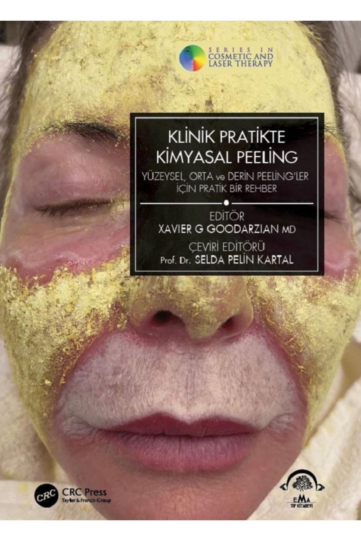 Ema Tıp Kitabevi Klinik Pratikte Kimyasal Peeling