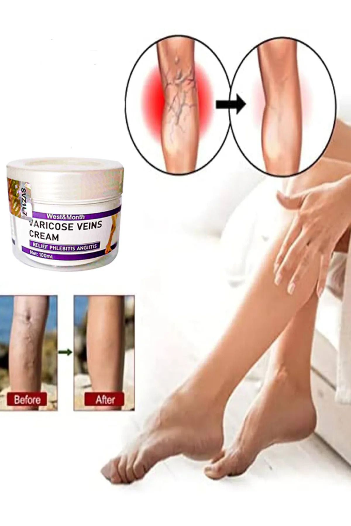 Varicose Veins Cream West&Month Selülit Karşıtı Bacak Bakım Kremi 100 ml