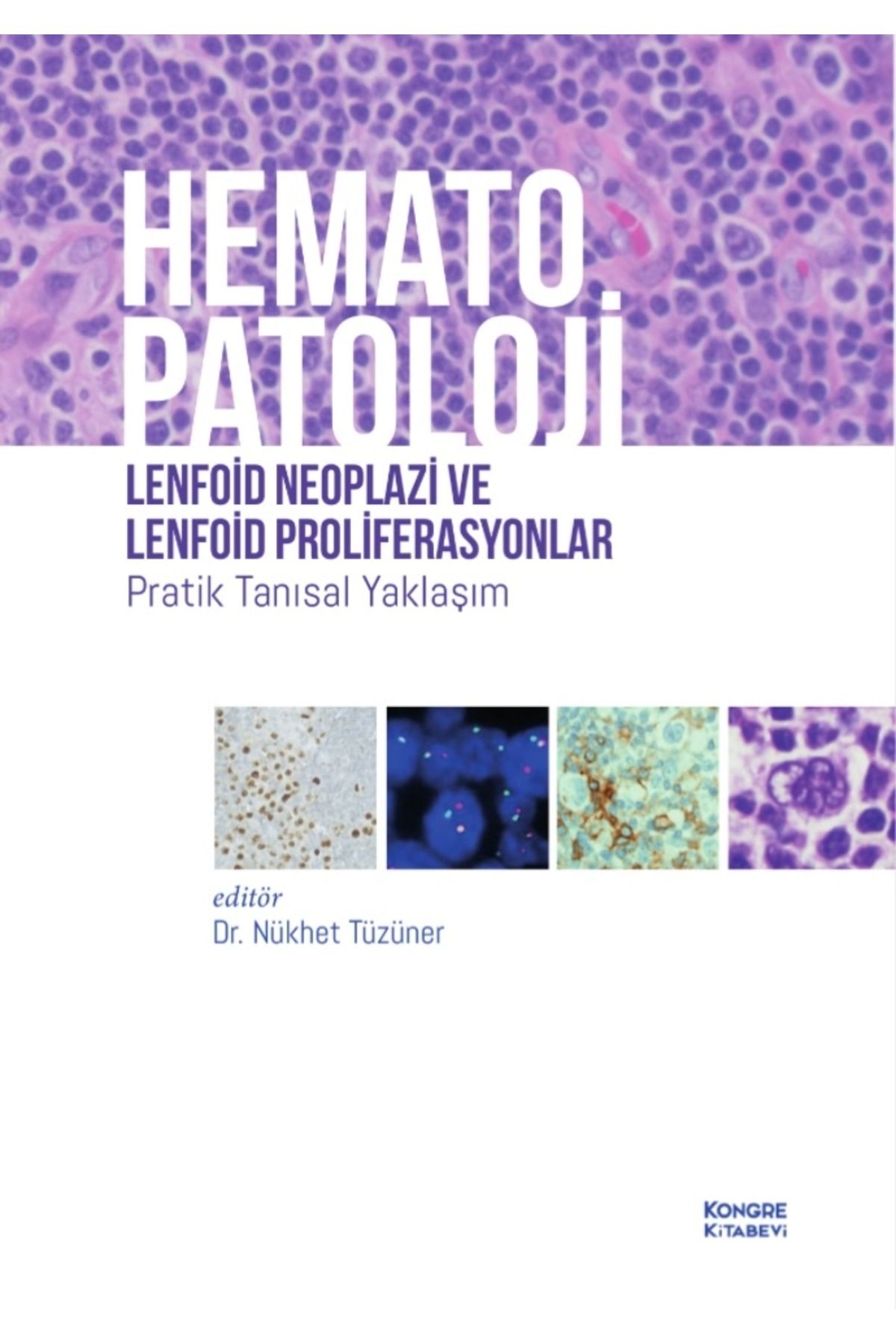 Kongre Kitabevi Hematopatoloji Lenfoid Neoplazi ve Lenfoid Proliferasyonlar Pratik Tanısal Yaklaşım