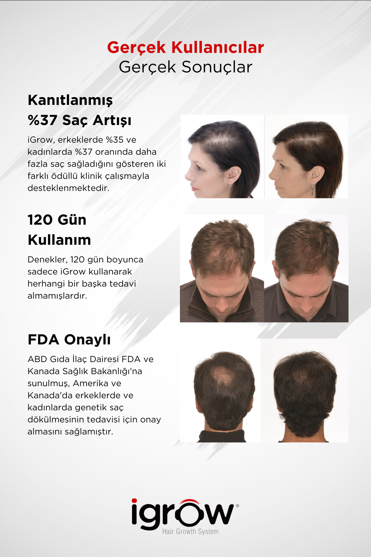 Igrow Lazerli Saç Çıkartma Ve Dolgunlaştırma Cihazı (fda Onaylı) — IG — تصویر 3 از 6