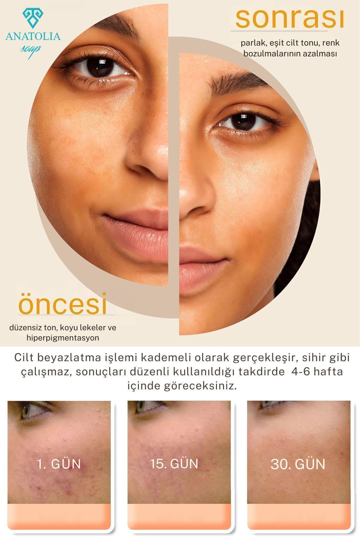 https://cdn.dsmcdn.com/ty1602/prod/QC/20241120/12/aaf194da-70d8-3a3d-af09-7a43be643df0/1_org_zoom.jpg