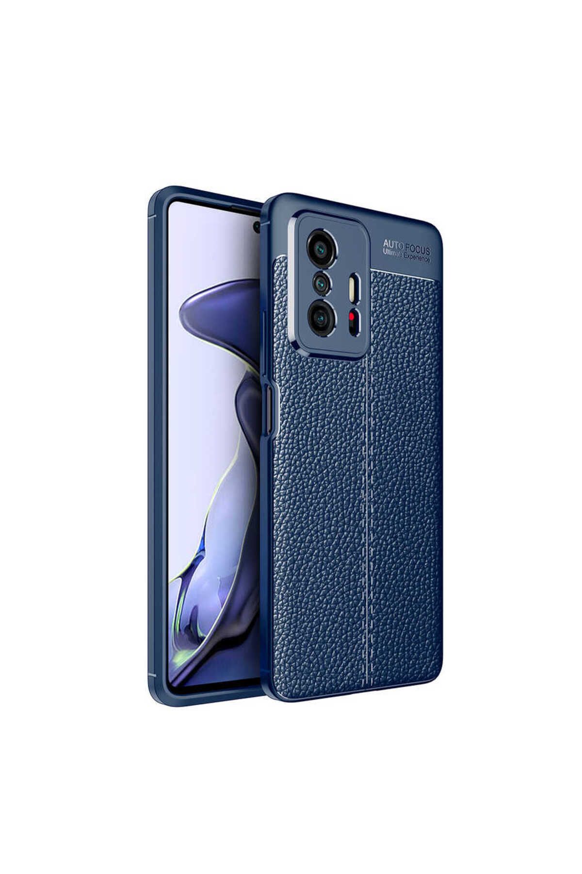 gaappy Diss Serisi Xiaomi Mi 11T Pro 5G Lacivert Kapak