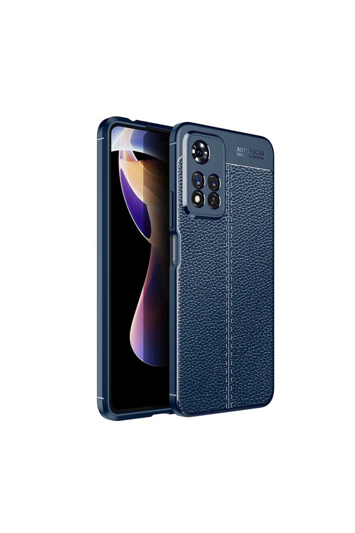 gaappy Diss Serisi Xiaomi Redmi Note 11E Lacivert Kapak