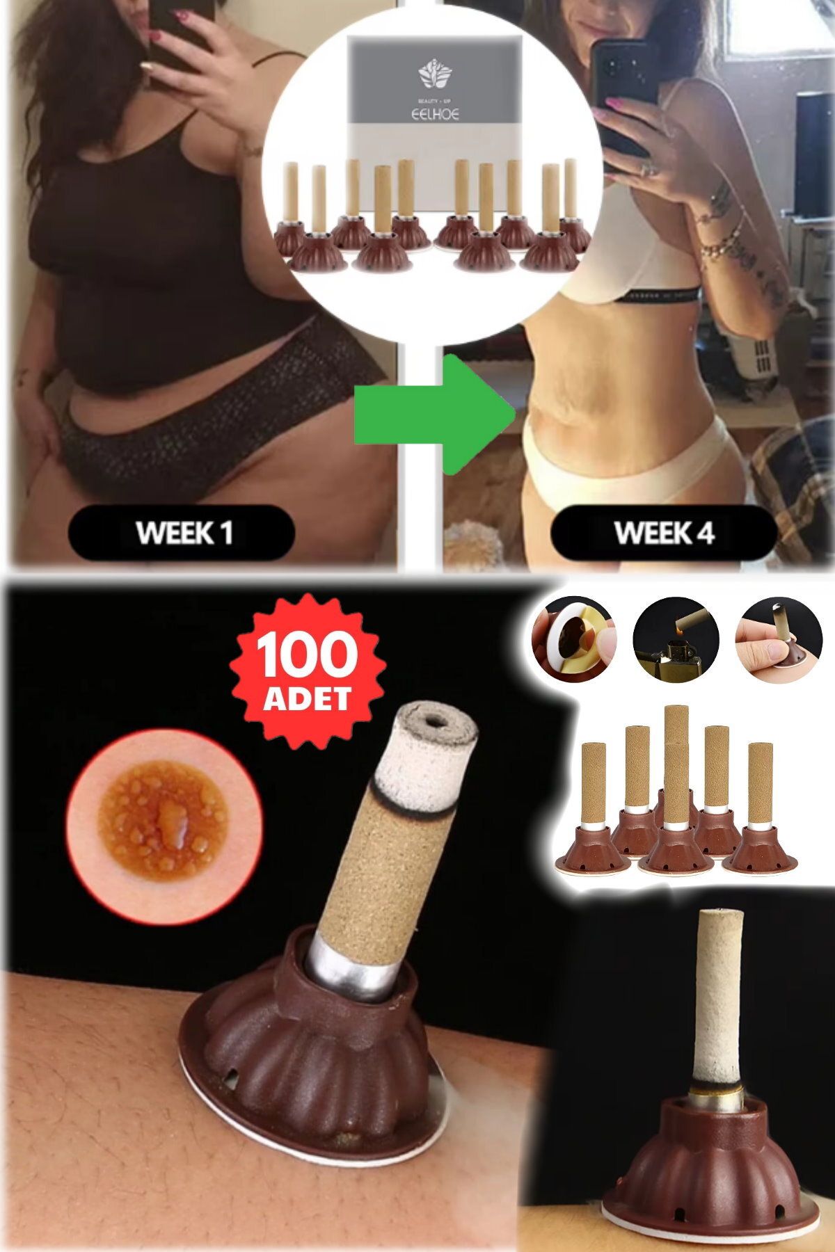 AboutThePerfect 1 Haftada 7 Kg Akupunktur ve Moxa Dumanı Seti