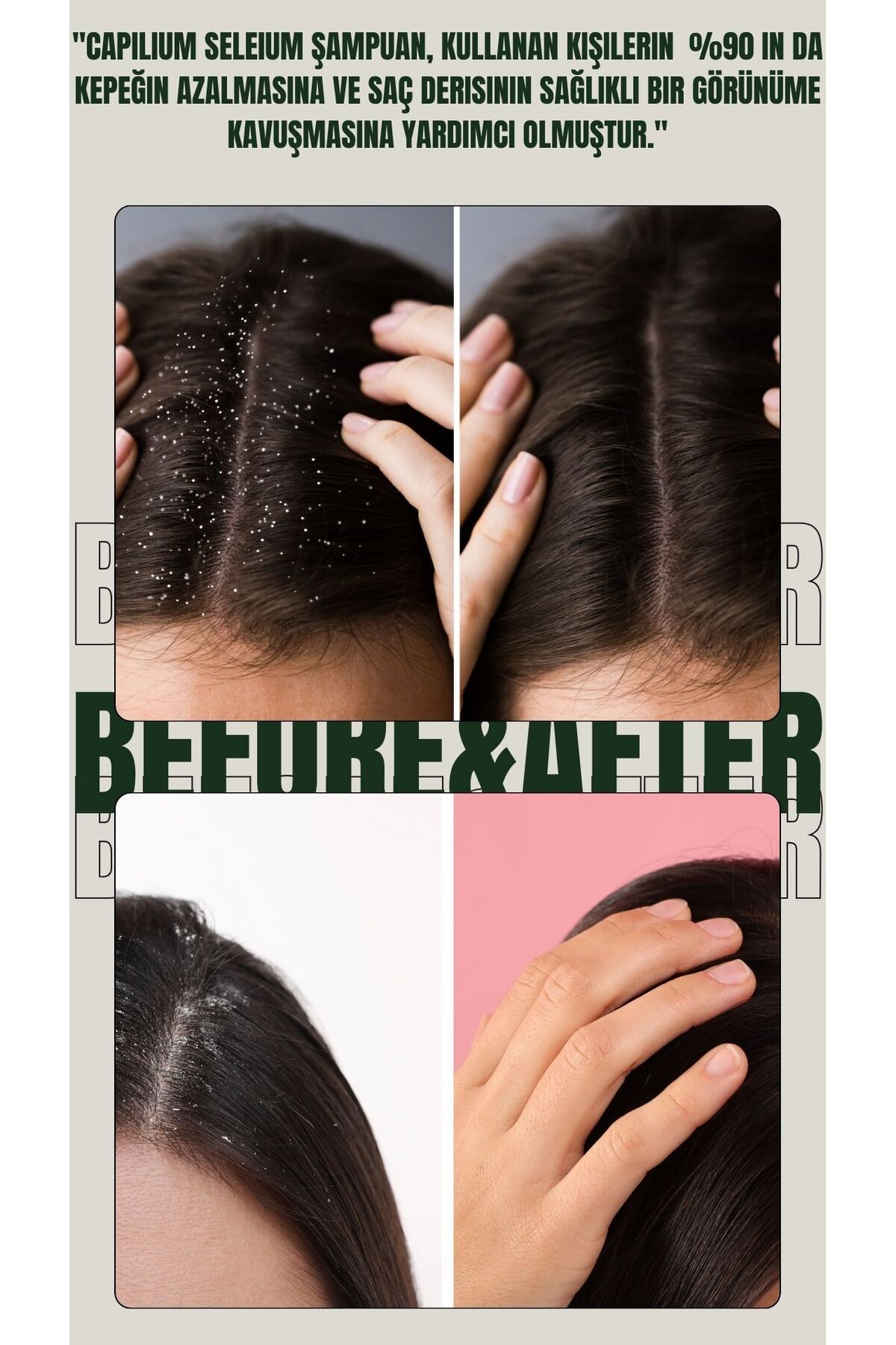 Capillium-Seborrheic and Anti-Selenic Shampoo to Prevent Dandruff, Itching and Flaking 3