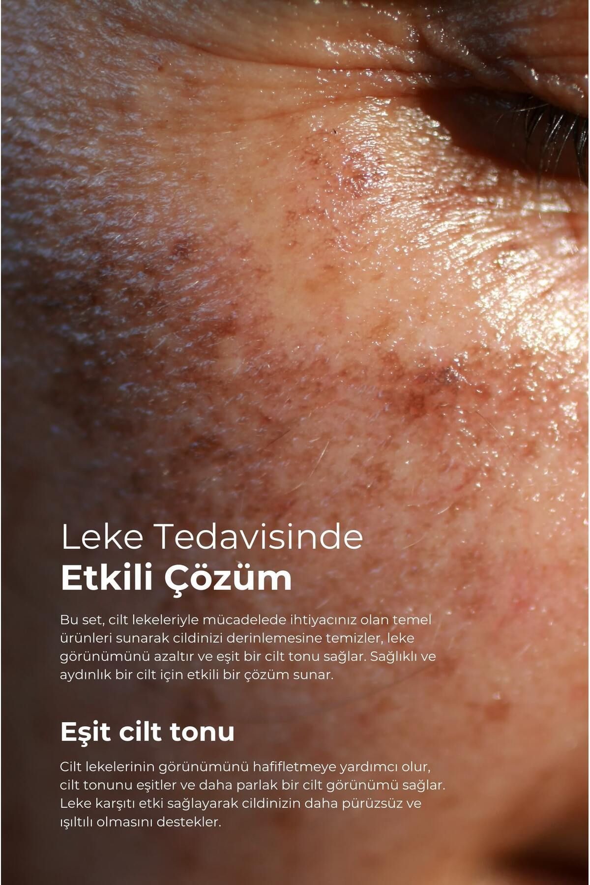 Tto CLINIC LEKE KREMİ 75ML + DERMODICOS PLUS KREM 30ML-3