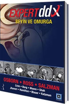 Expert Ddx: Beyin Ve Omurga Yayınevi -9991165-10ae9