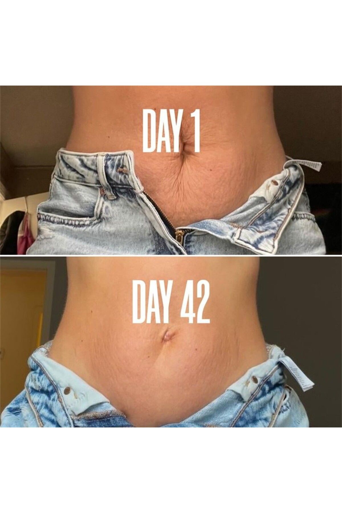 Choice-Stretch Marks Removal Cream Eliminate Body Belly Stretch Marks Swelling Marks Remove Loose Skin R... 4