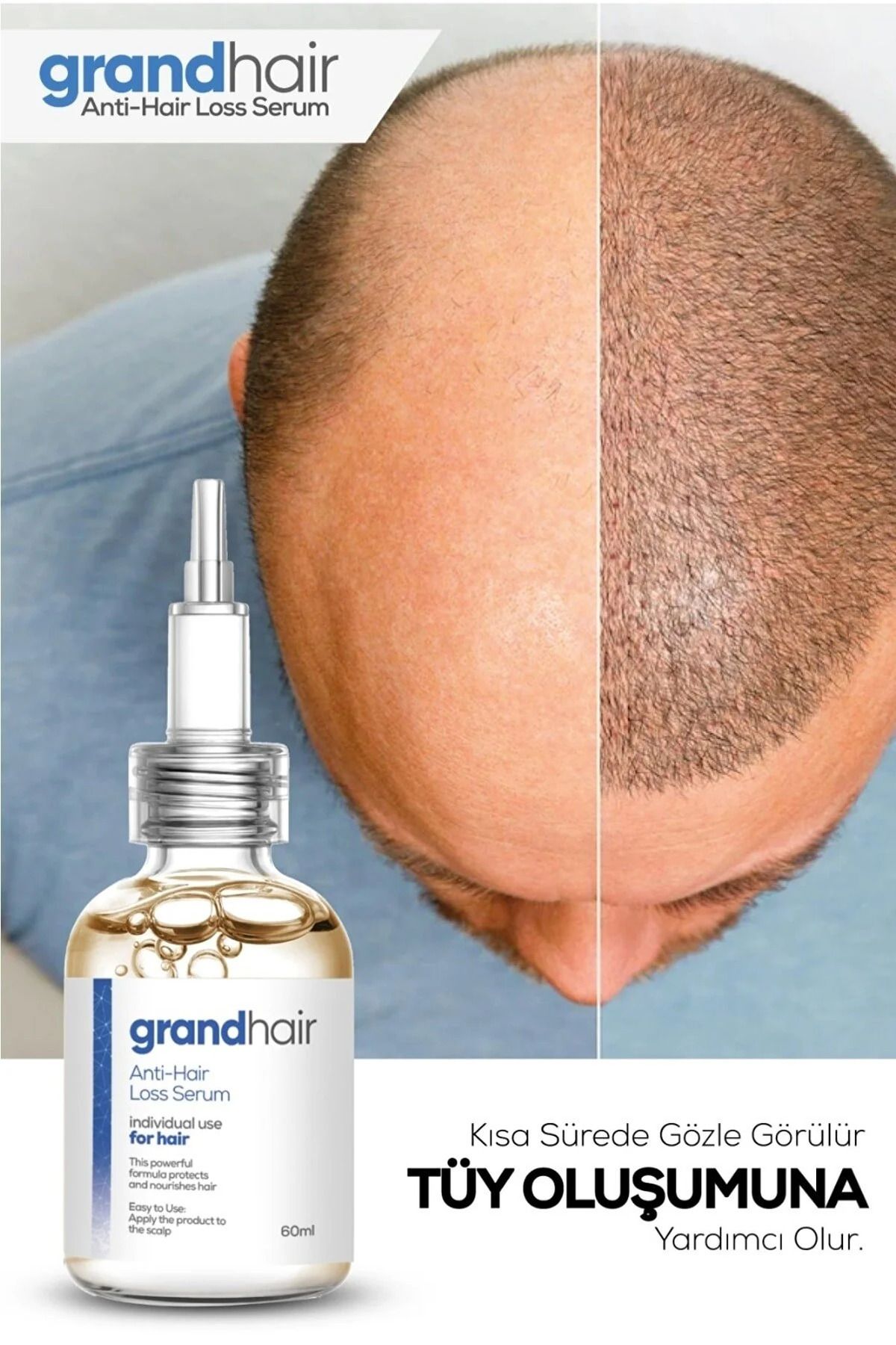 Grandhair Saç Dökülmelerine Karşı Etkili Bakım Serumu 60 Ml-5