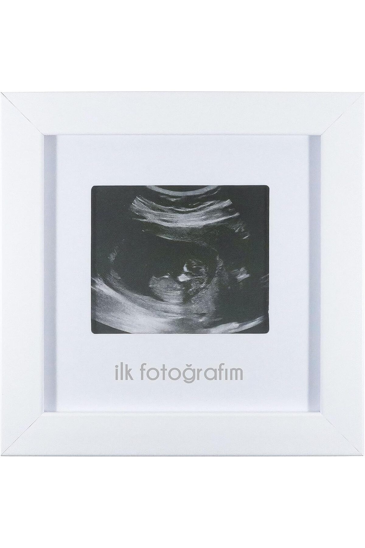 STOREMAX İlk Fotoğrafım Bebek Ultrason Çerçevesi - Bebek Odası Resim Anı Çerçevesi