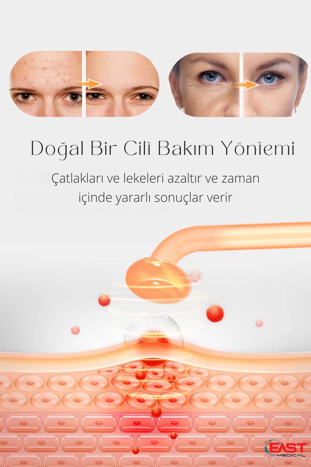 east medical Yüksek Frekans Cihazı 4 Problu Yüz Cilt Bakım Cihazı Gençleştirme Anti-aging High Frequenc-5