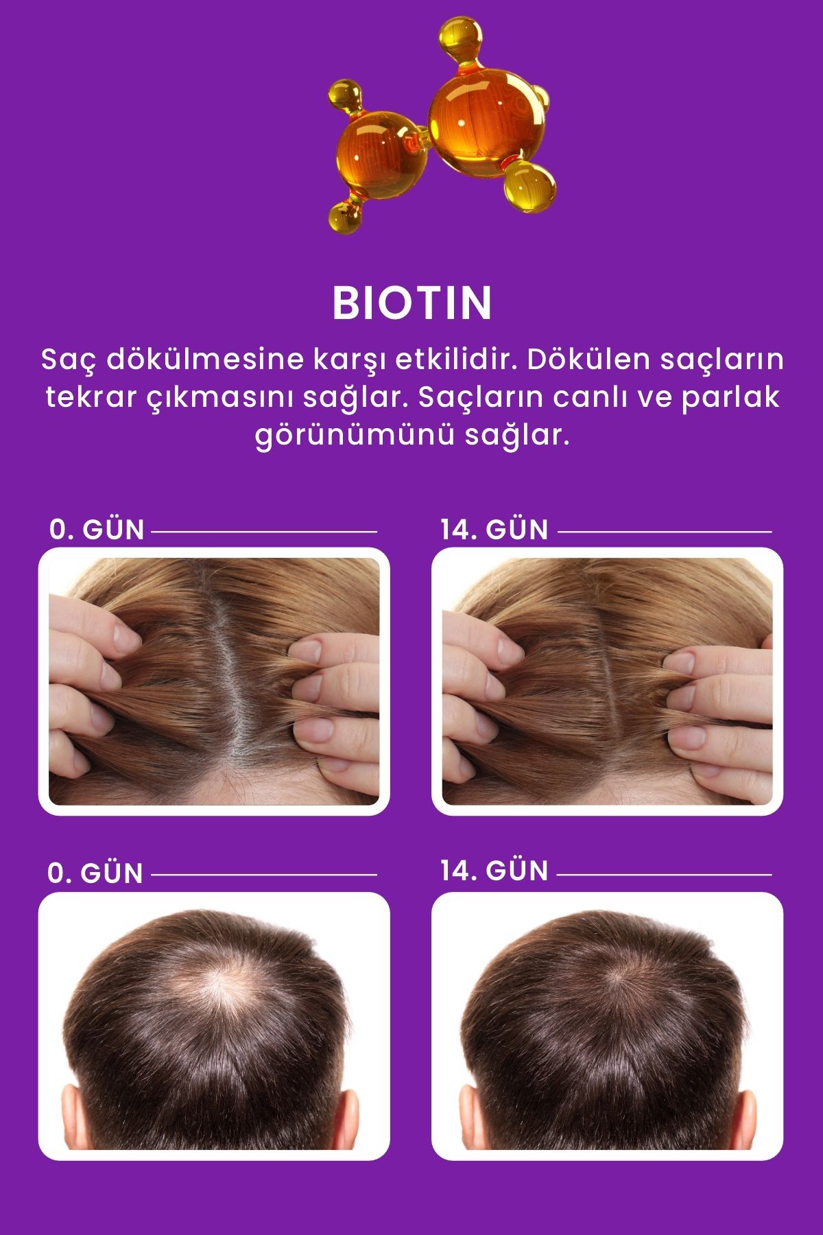 LES VHES Kolajen Ve Keratin Dökülen Ve Geç Uzayan Saçlar Için 11 Aktifli Saç Dökülmesi Karşıtı Şampuan 300 ml-2