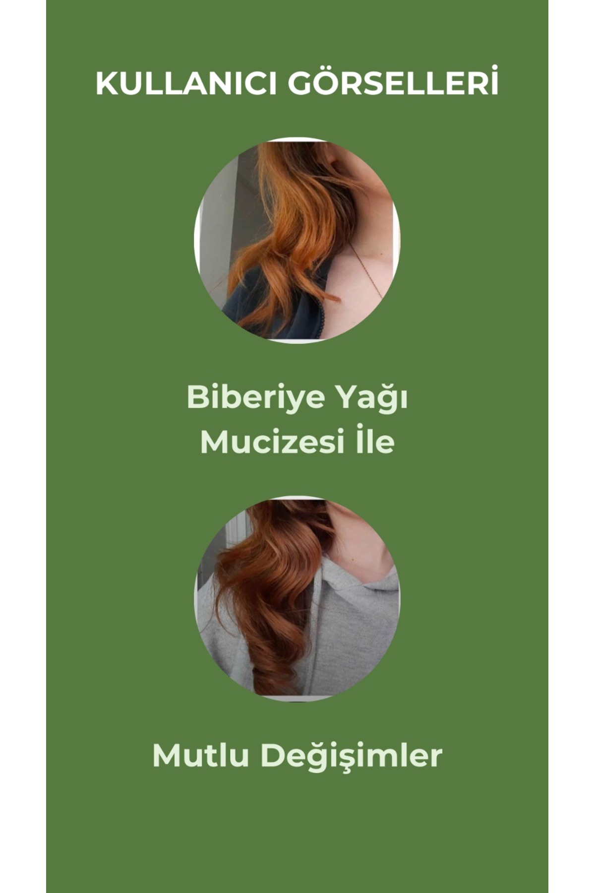 Biberiye Yağı Complexi Saç Dökülmesi Ve Yıpranmış Saçlar Için Hızlı Saç Uzatan Biotinli Saç Bakımı — 2 — تصویر 7 از 7