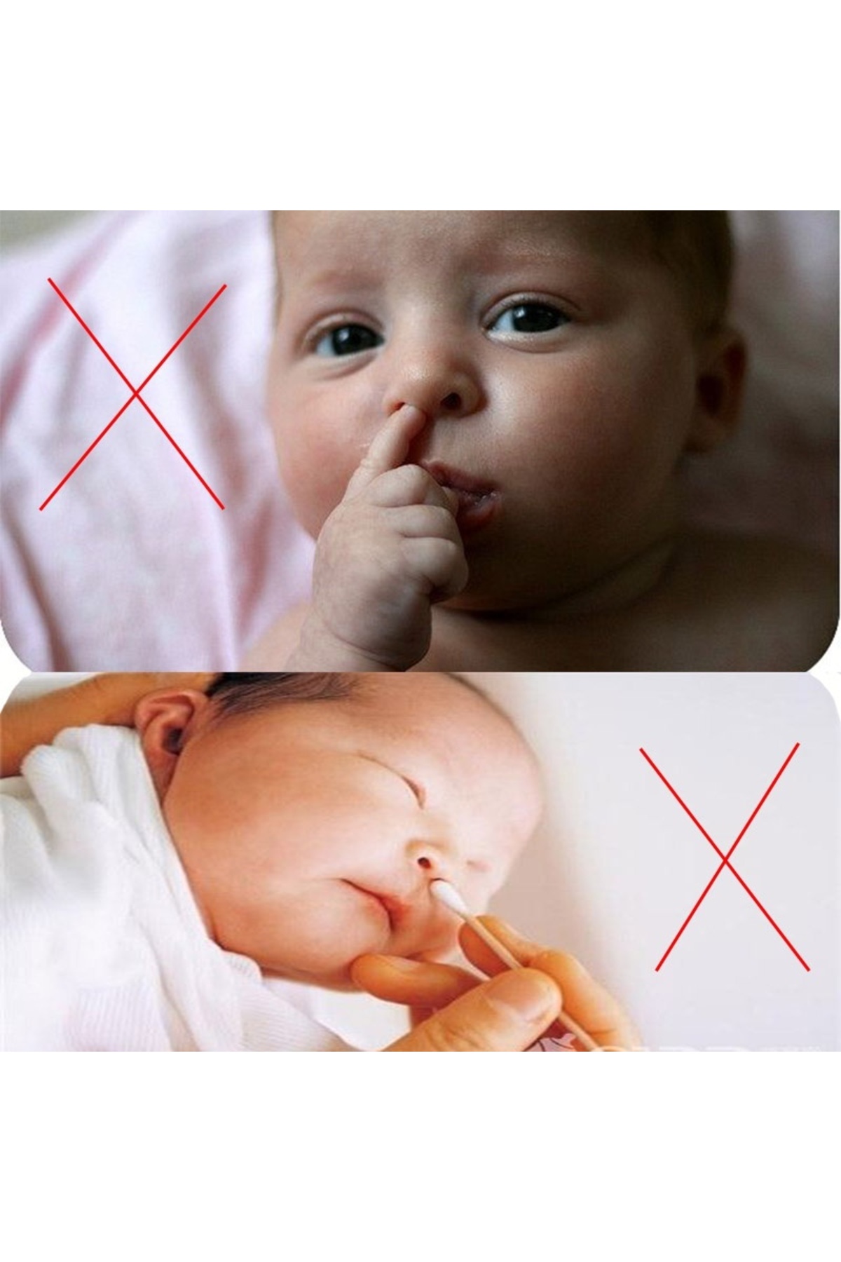 KdrElektronik Bebek burun temizleme cımbız bebek kulak içi burun göbek temizleme aparatı turuncu renk fotoğrafı 5 (önizleme)