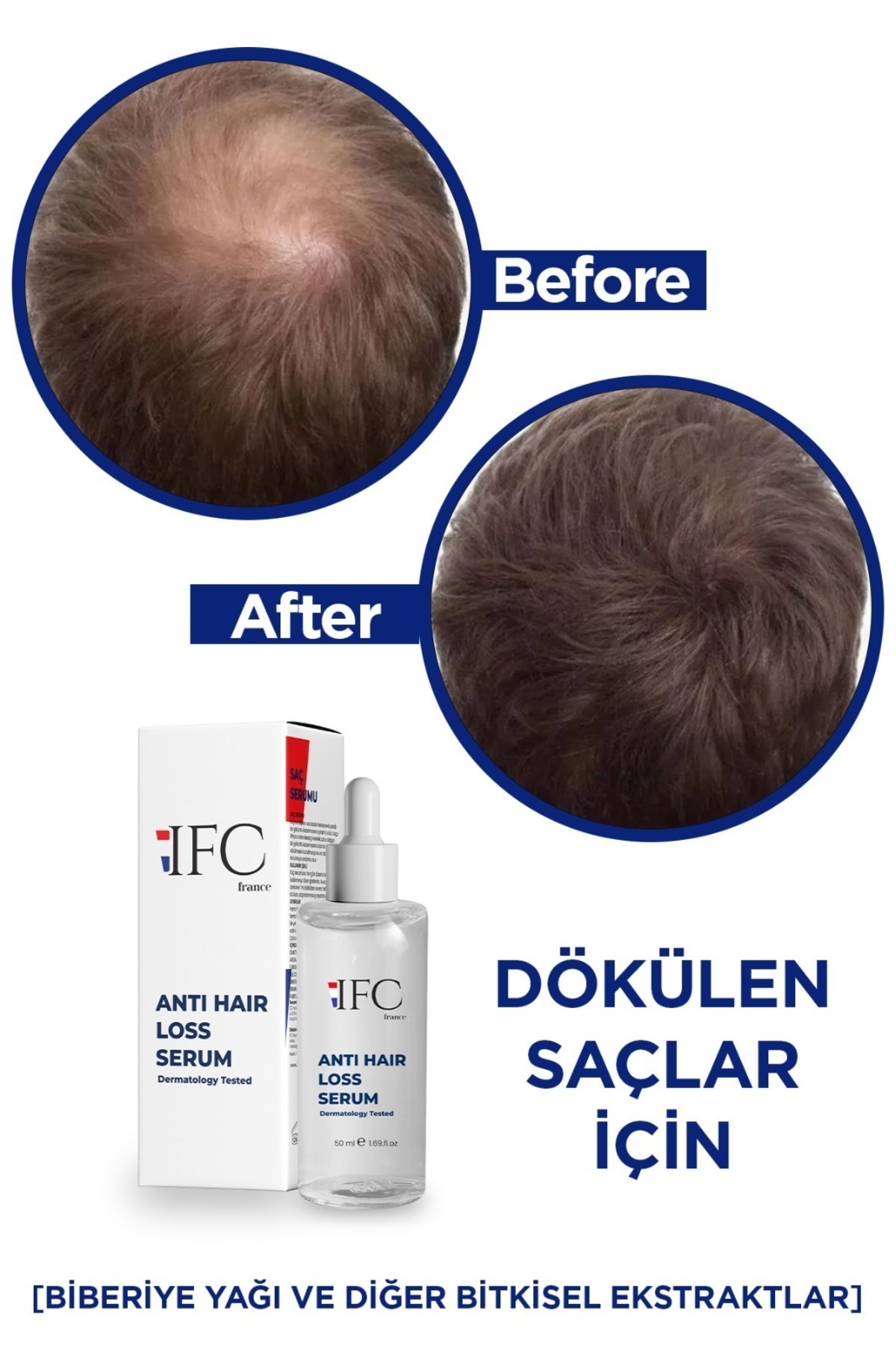 سرم ضد ریزش مو با کمپلکس روغن رزماری - سرم و روغن تقویت کننده ریشه مو — IFCDOKSERUM — تصویر 6 از 8