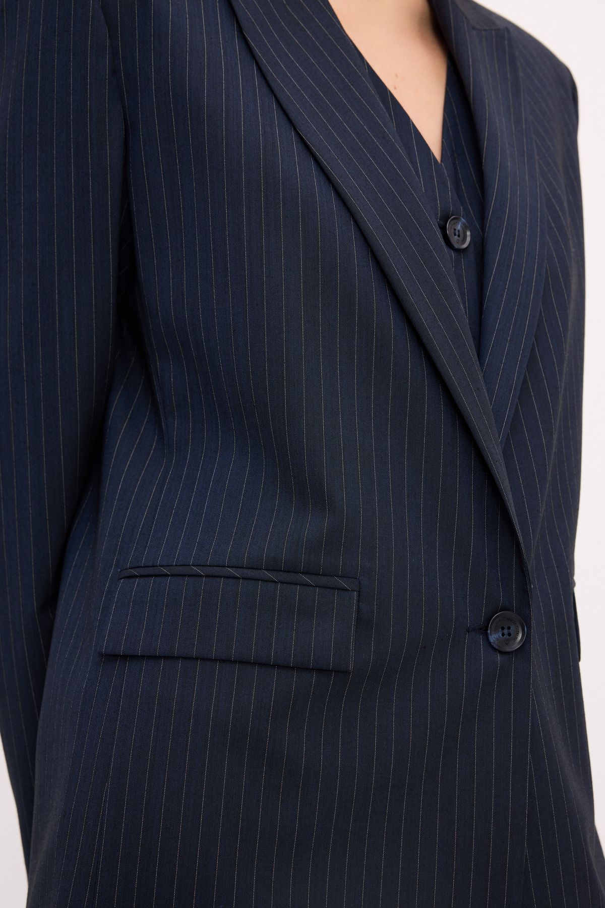 Love My Body-Fashion Passion Striped Jacket 3