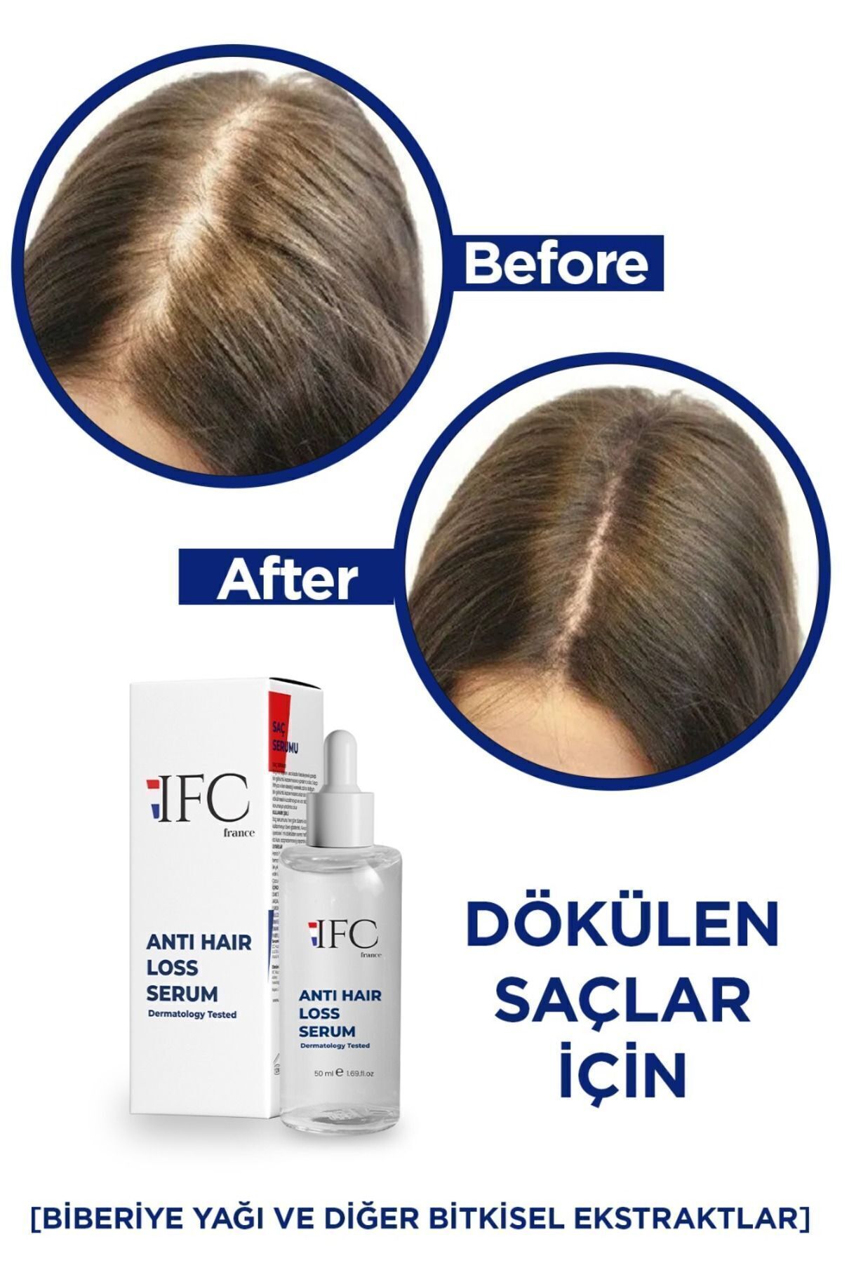 سرم ضد ریزش مو با کمپلکس روغن رزماری - سرم و روغن تقویت کننده ریشه مو — IFCDOKSERUM — تصویر 5 از 8