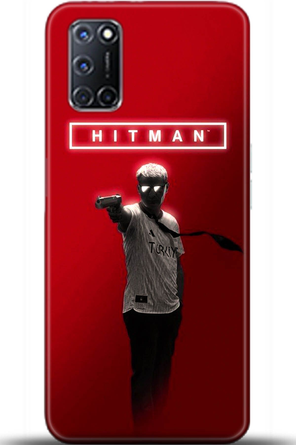 OPPO A72 Kılıf HD Baskılı Kılıf - Loving You Series 5510
