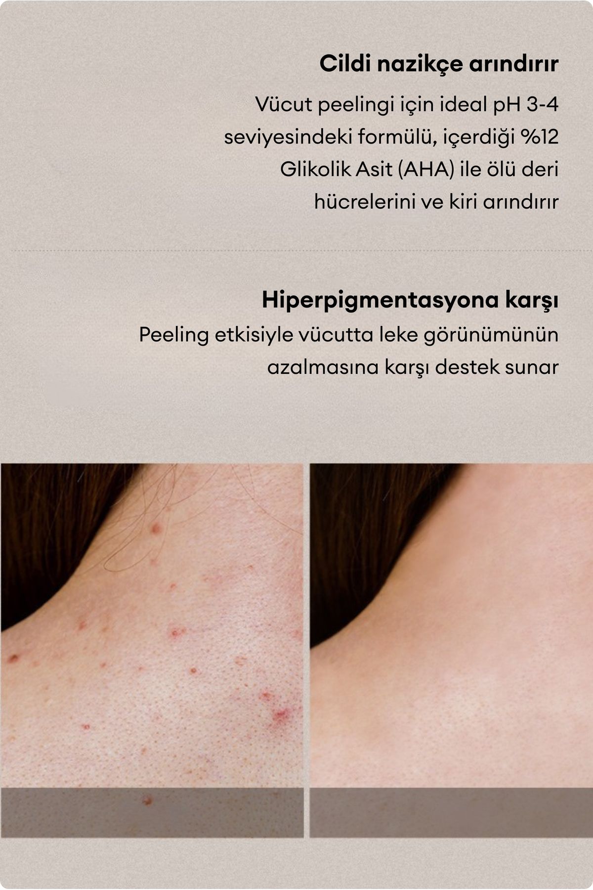 Village 11 Factory-Relax Day Aha - Purifying Glycolic Acid Body Peeling Lotion Against Ingrown Spots and Blackening 3