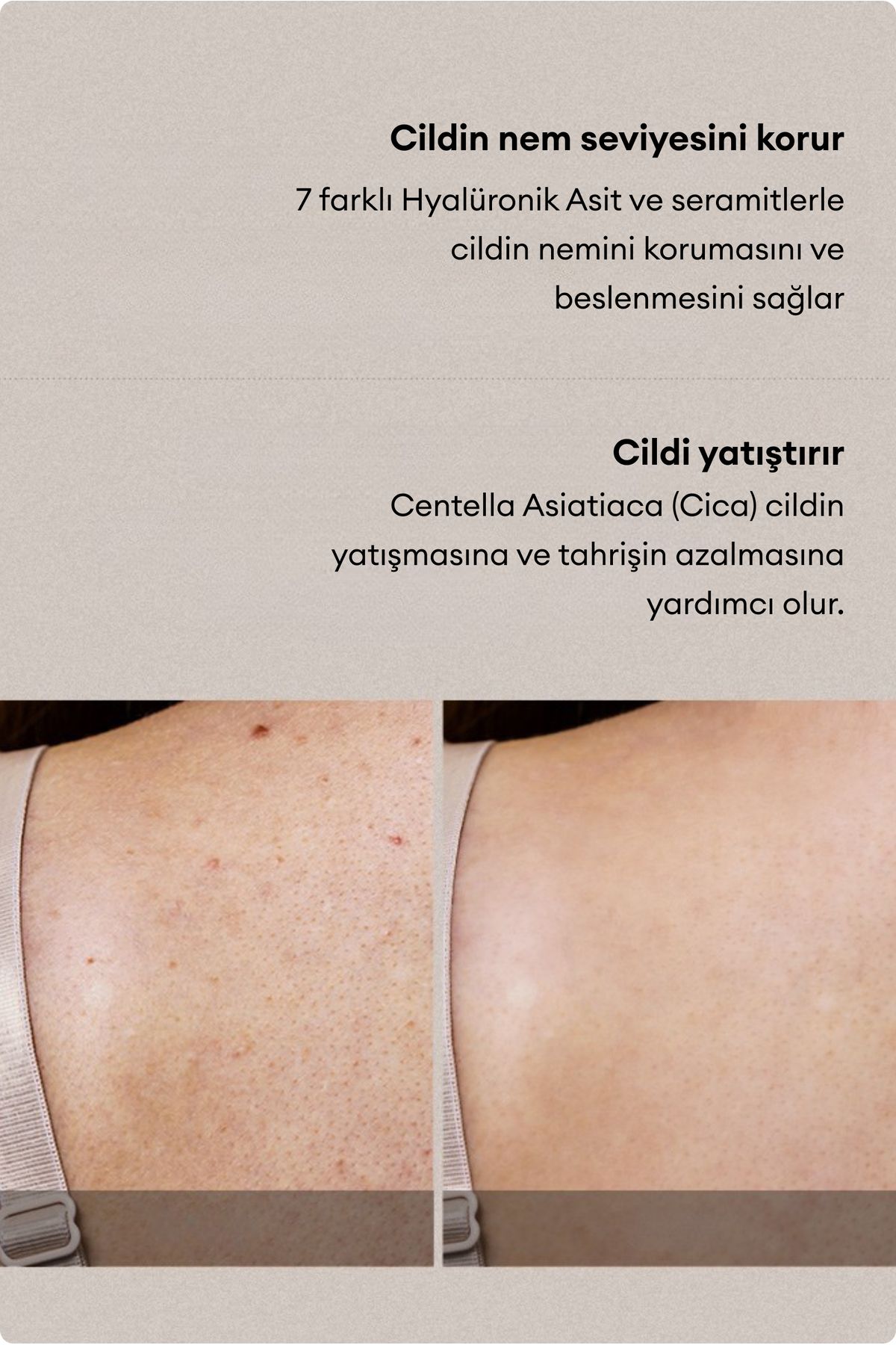 Village 11 Factory-Relax Day Aha - Purifying Glycolic Acid Body Peeling Lotion Against Ingrown Spots and Blackening 5