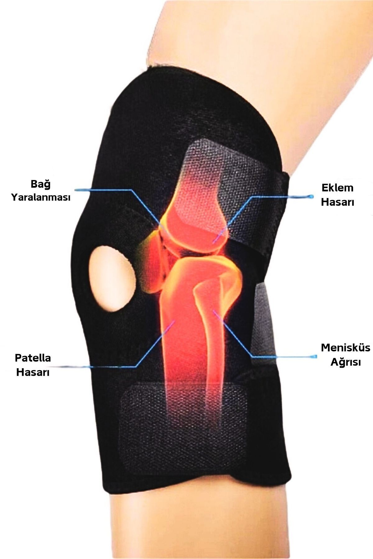 teknotrust Patella Desteli Dizlik Menisküs Dizlik Diz Bandajı Bandı Diz Için Patella Destekli Bandaj