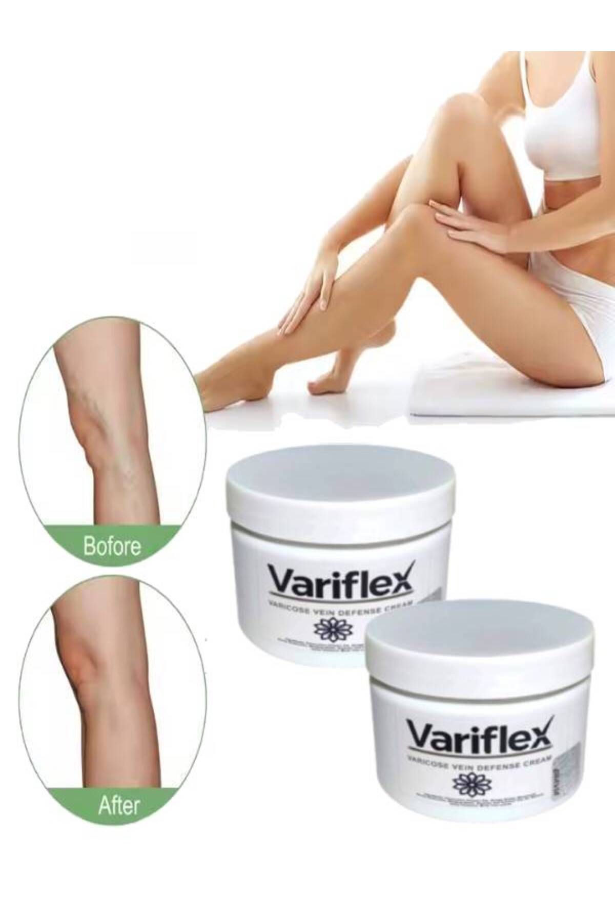 MA CREAM Variflex Kadınlar İçin Varicosel-Selulıt Bakım Creami 150 ml x 2 adet