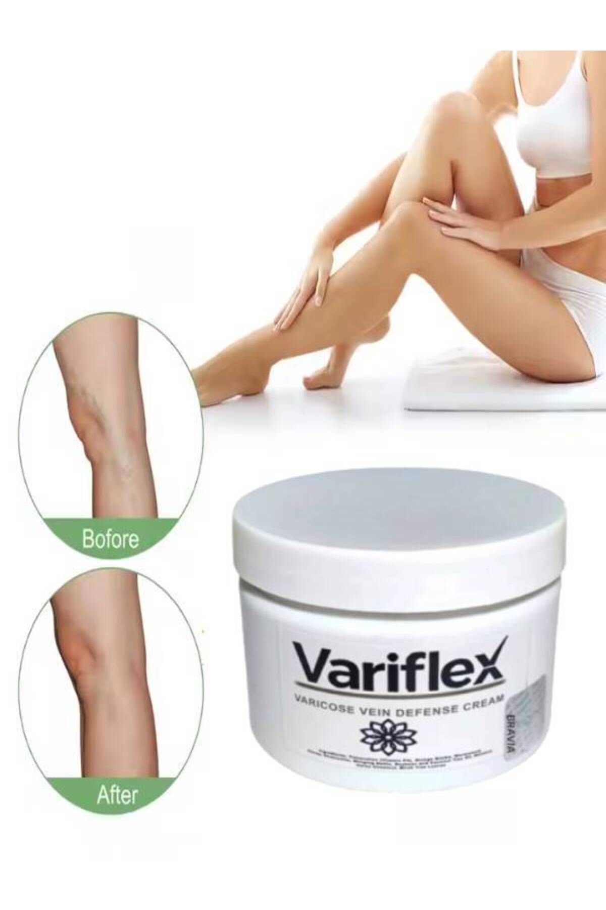 MA CREAM Variflex Kadınlar İçin Varicosel-Selulıt Bakım Creami 150 ml x 1 adet