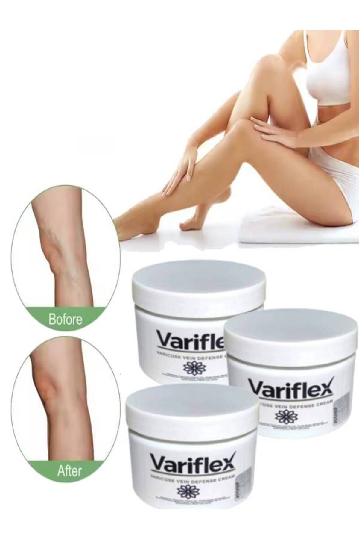 MA CREAM Variflex Kadınlar İçin Varicosel-Selulıt Bakım Creami 150 ml x 3 adet