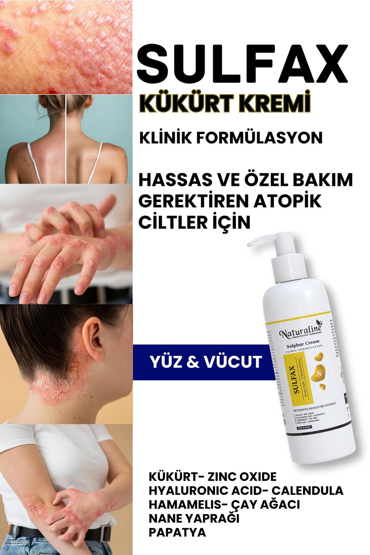 Naturaline Professional Kükürtlü Sulfax Lekeli Cilt & Egzamaya Karşı Krem 100 ml