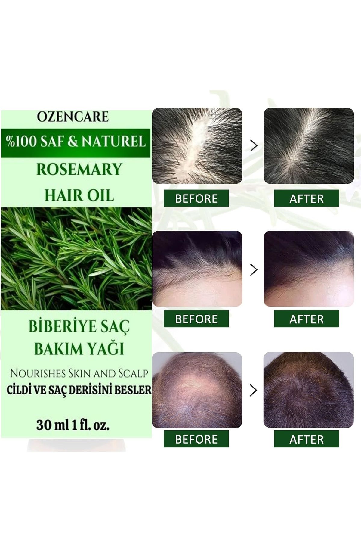 OzenCare Saç İçin Biberiye Yağı,Biberiye Saç Bakım Yağı,Saç Dökülme Karşıtı,Hızlı Saç Uzatan,Rosemary Oil 30M