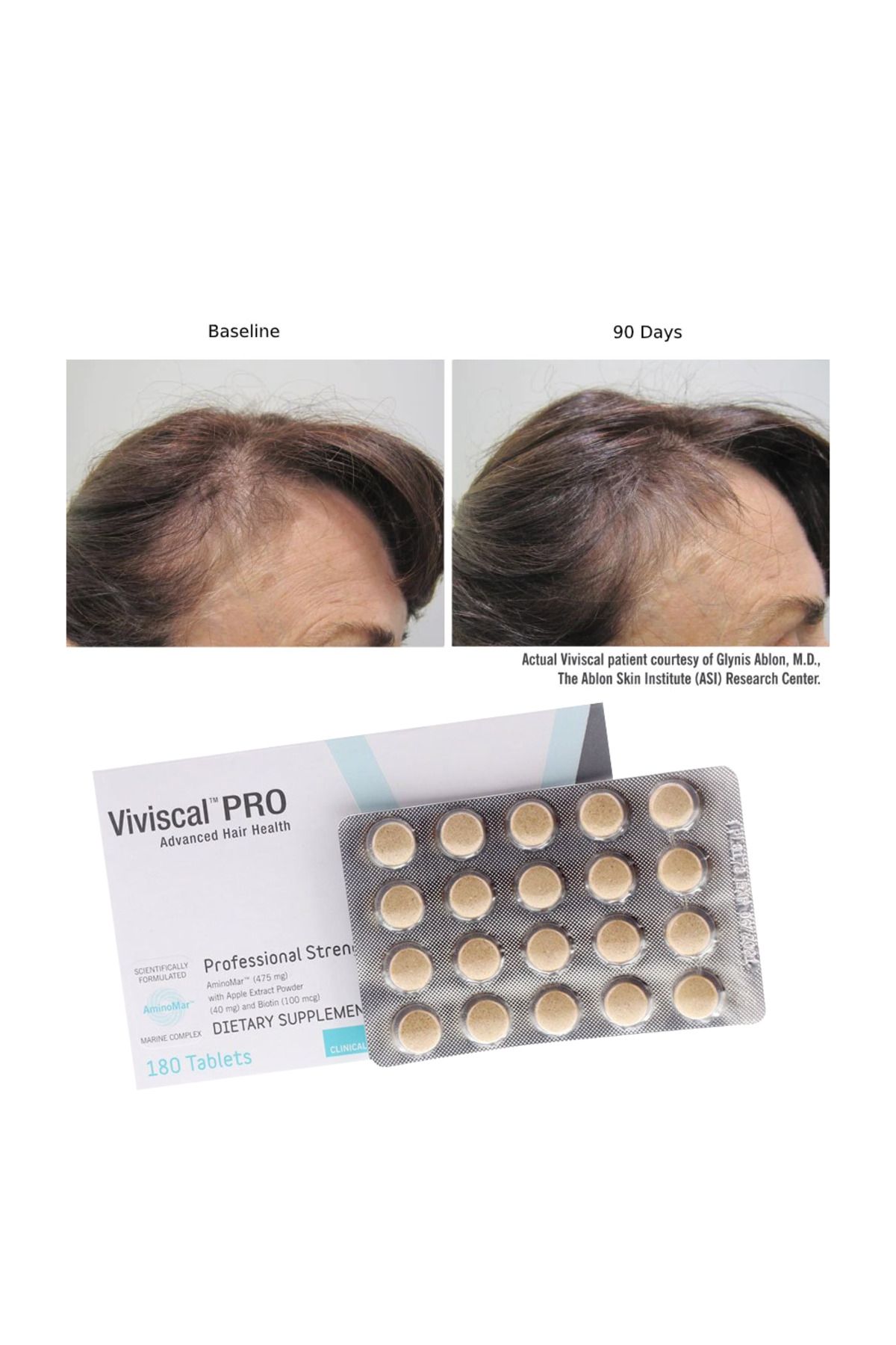 Viviscal Professional-Dietary Supplement for Hair Growth, 180 Tablets (3 month supply) 3