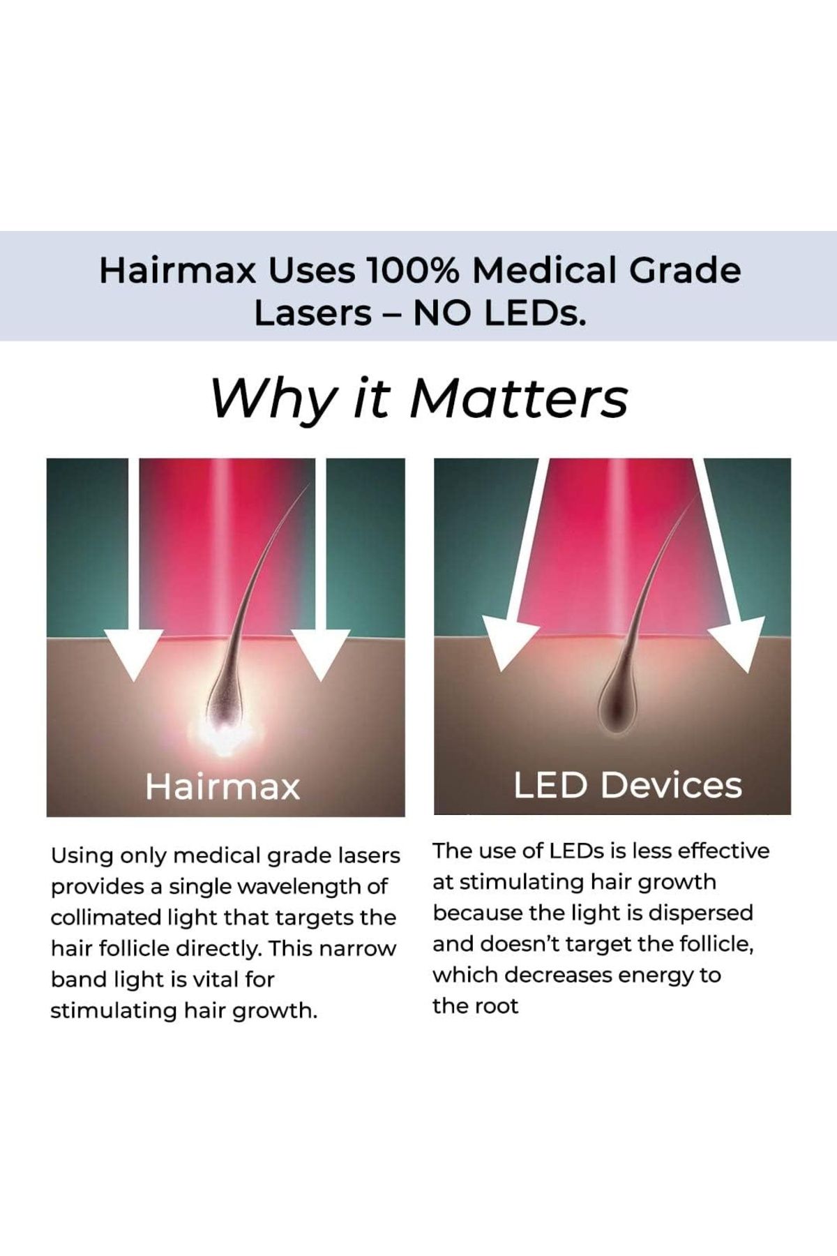 Hairmax-LaserBand 82 Comfortflex (FDA Cleared) 3