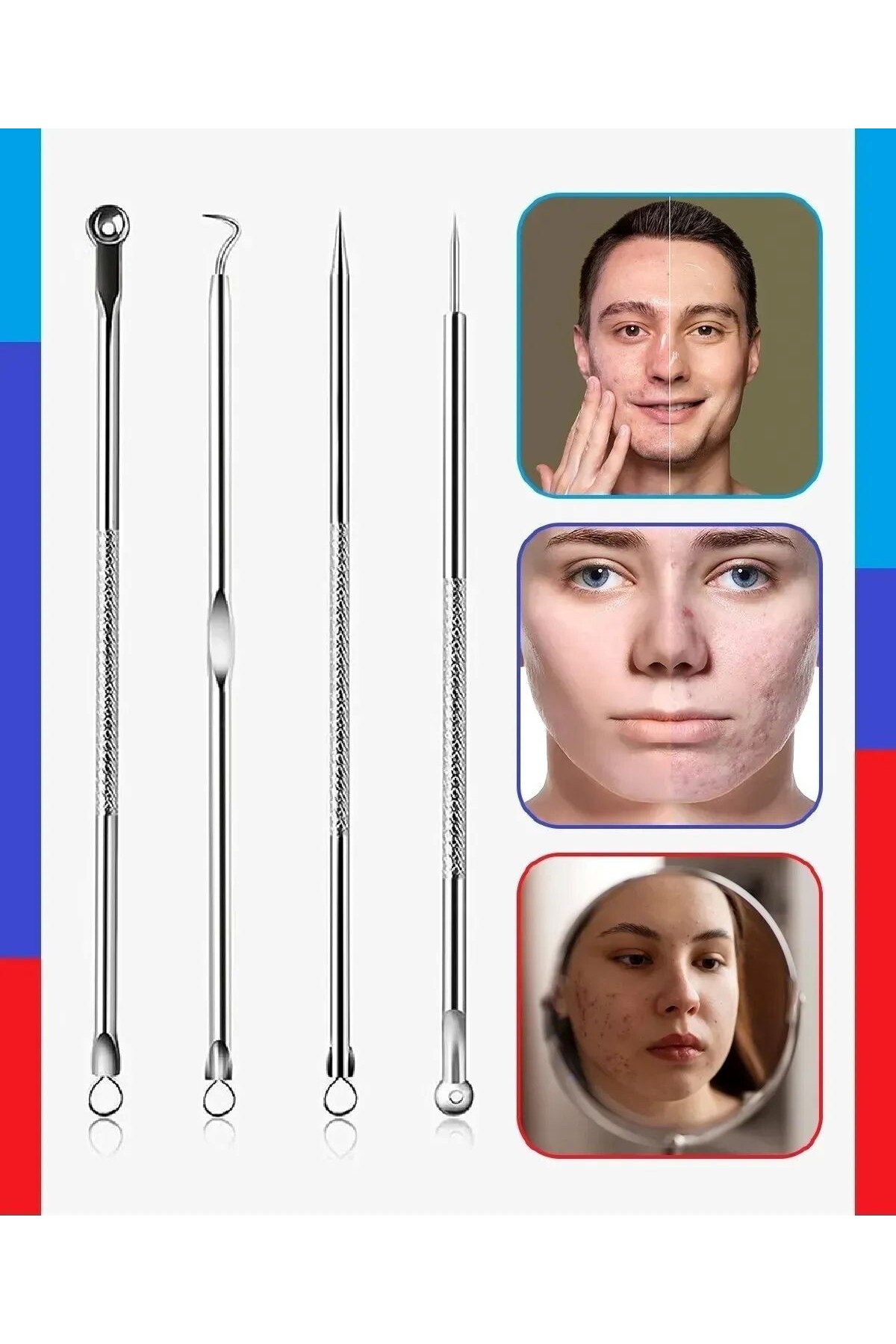 ست 4 تکه پاک کننده جوش سرسیاه و آکنه جعبه ای، ست کومدون استیل ضد زنگ — acne-set-3 — تصویر 8 از 8