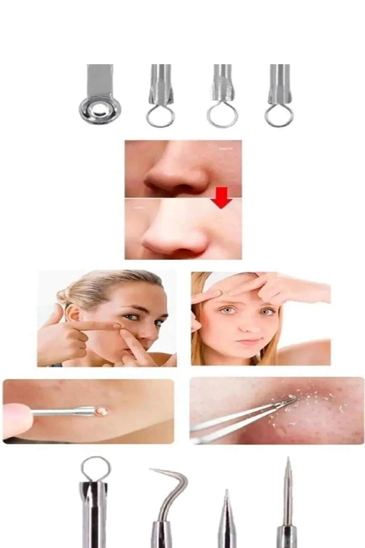 ست 4 تکه پاک کننده جوش سرسیاه و آکنه جعبه ای، ست کومدون استیل ضد زنگ — acne-set-3 — تصویر 7 از 8